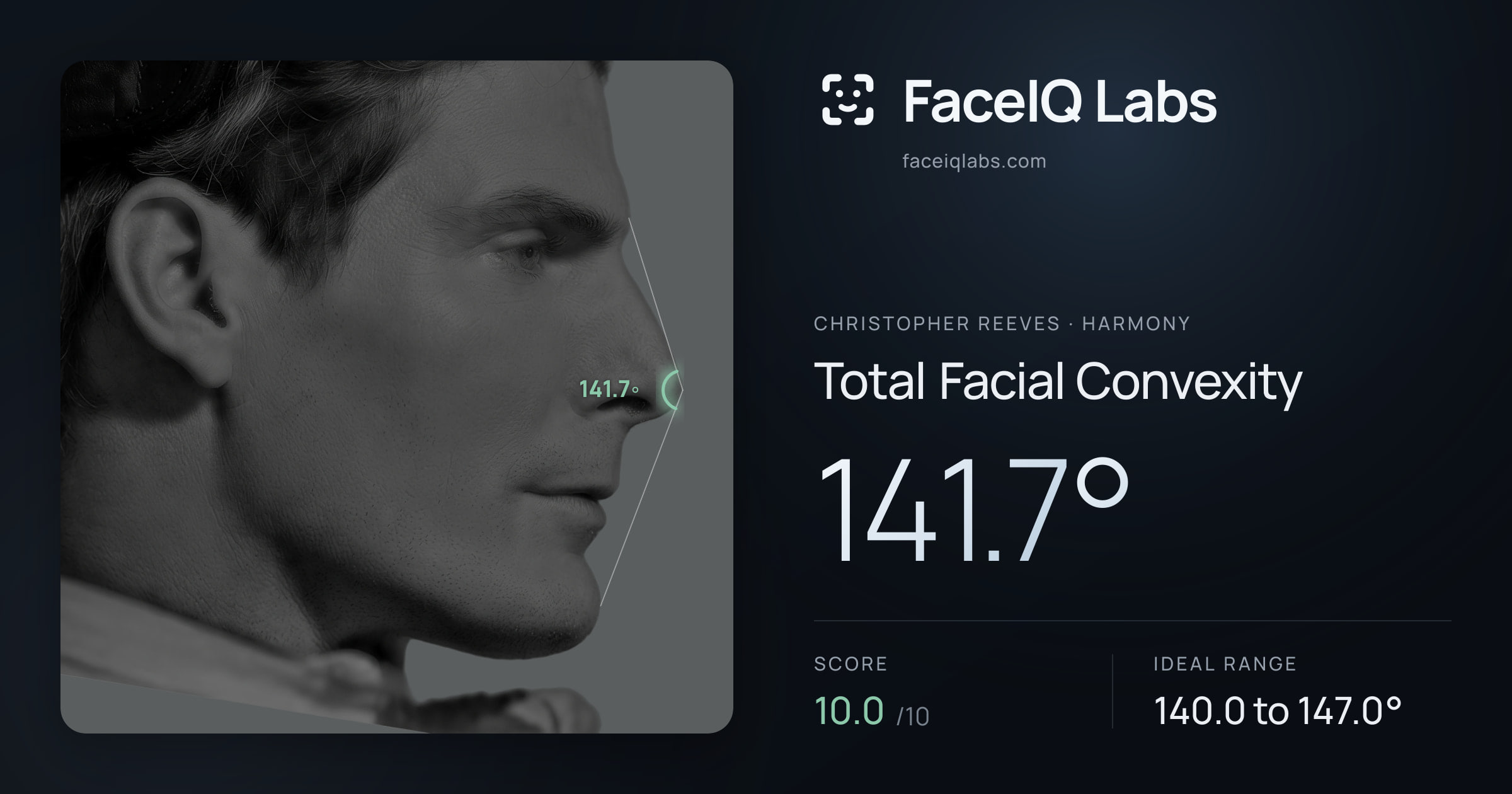 Christopher Reeves Total Facial Convexity: 141.7°, drawn on the photo
