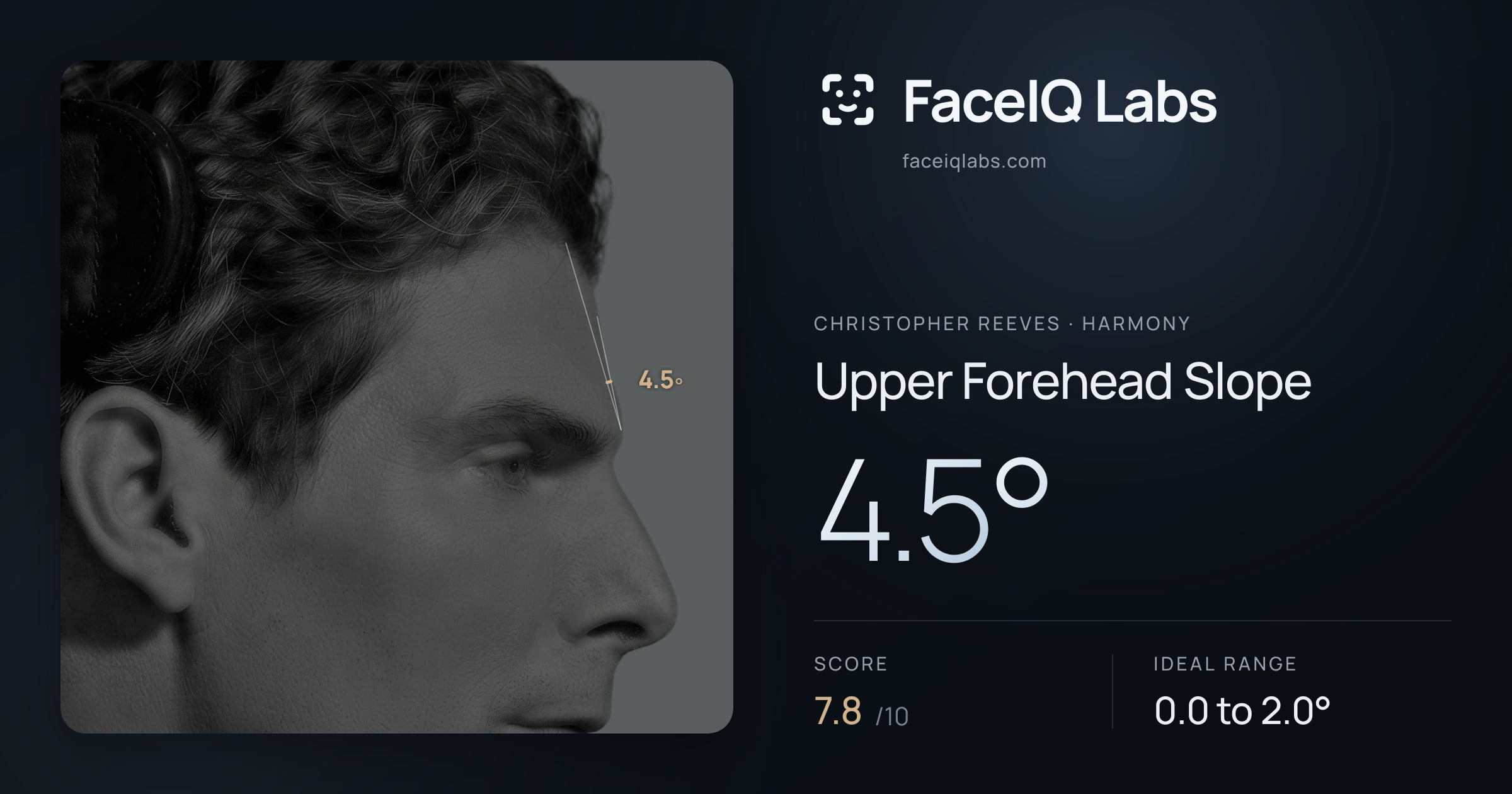 Christopher Reeves Upper Forehead Slope: 4.5°, drawn on the photo