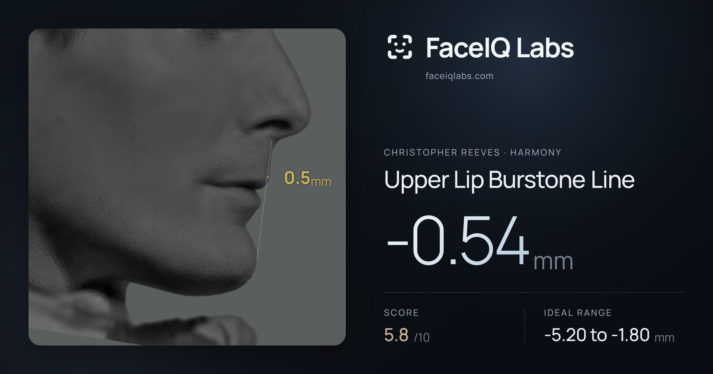 Christopher Reeves Upper Lip Burstone Line: -0.54mm, drawn on the photo