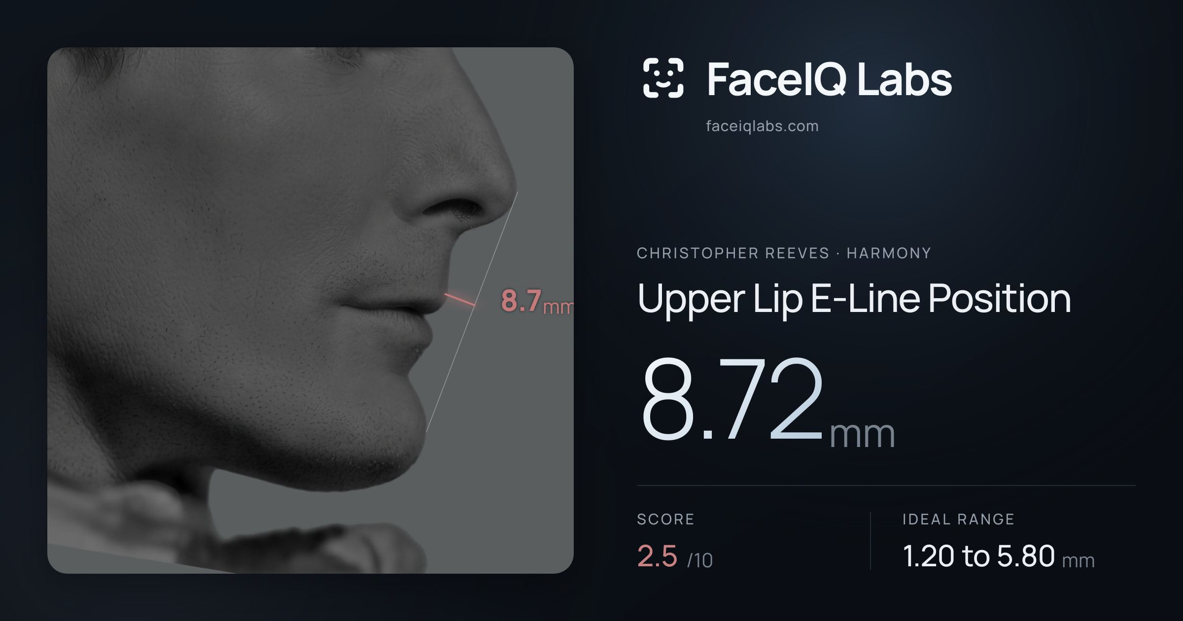Christopher Reeves Upper Lip E-Line Position: 8.72mm, drawn on the photo