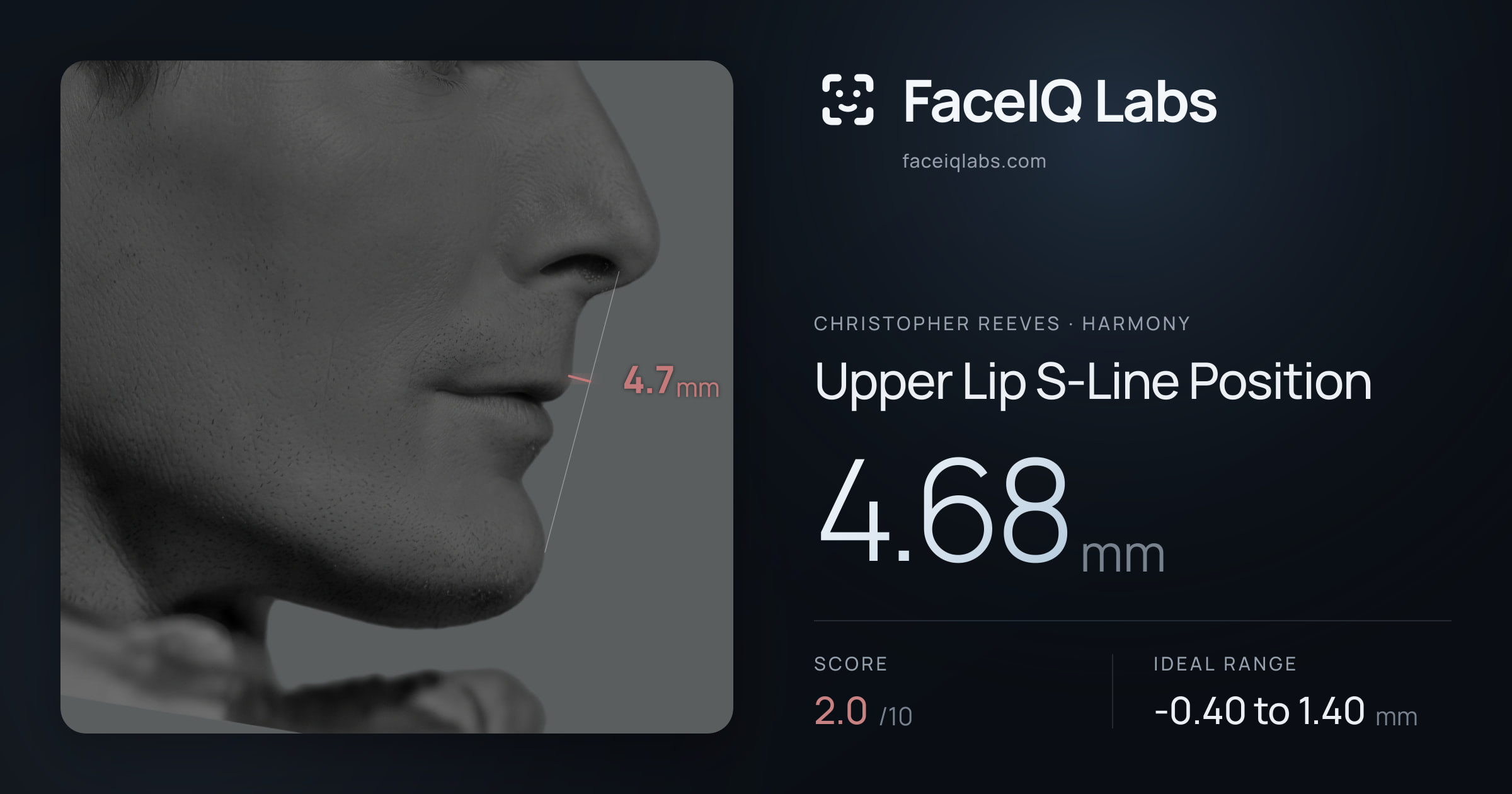Christopher Reeves Upper Lip S-Line Position: 4.68mm, drawn on the photo