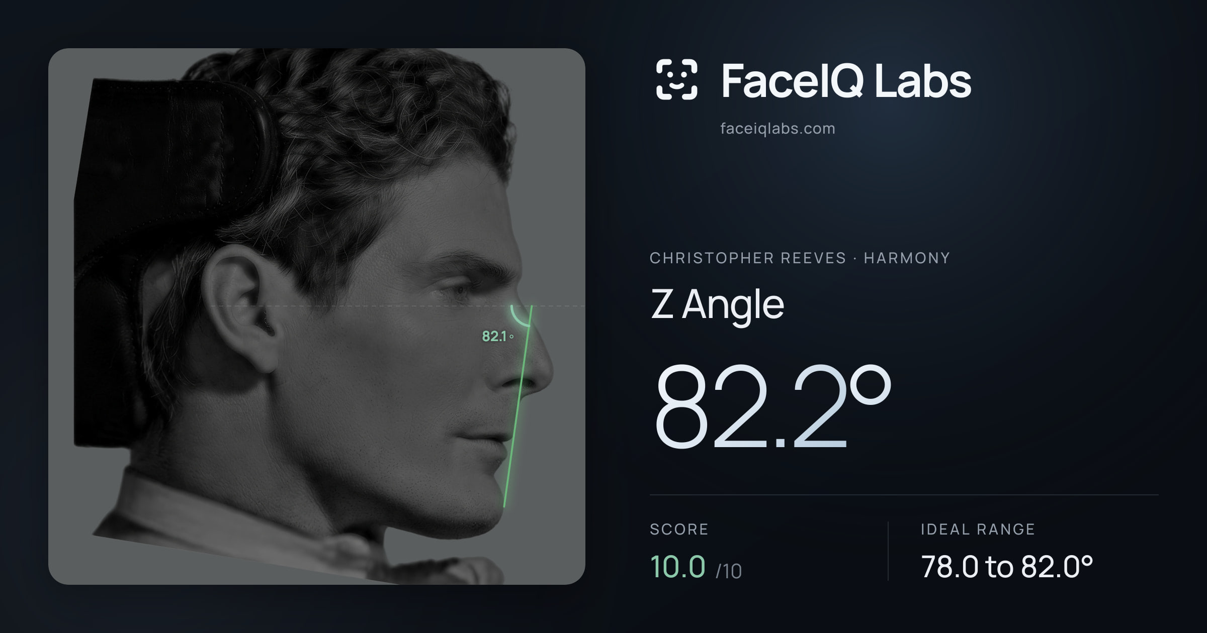 Christopher Reeves Z Angle: 82.2°, drawn on the photo