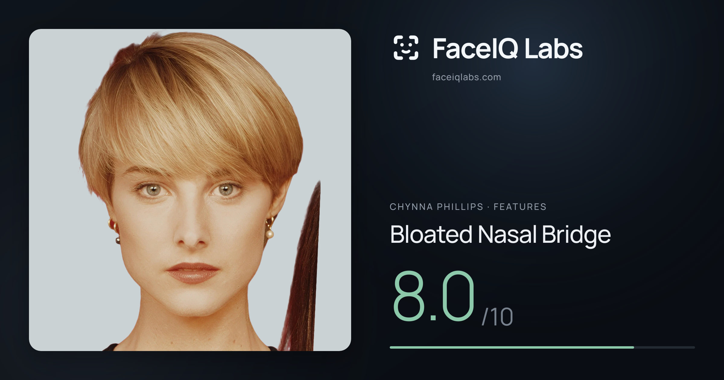 Chynna Phillips Bloated Nasal Bridge: 8.0/10, drawn on the photo