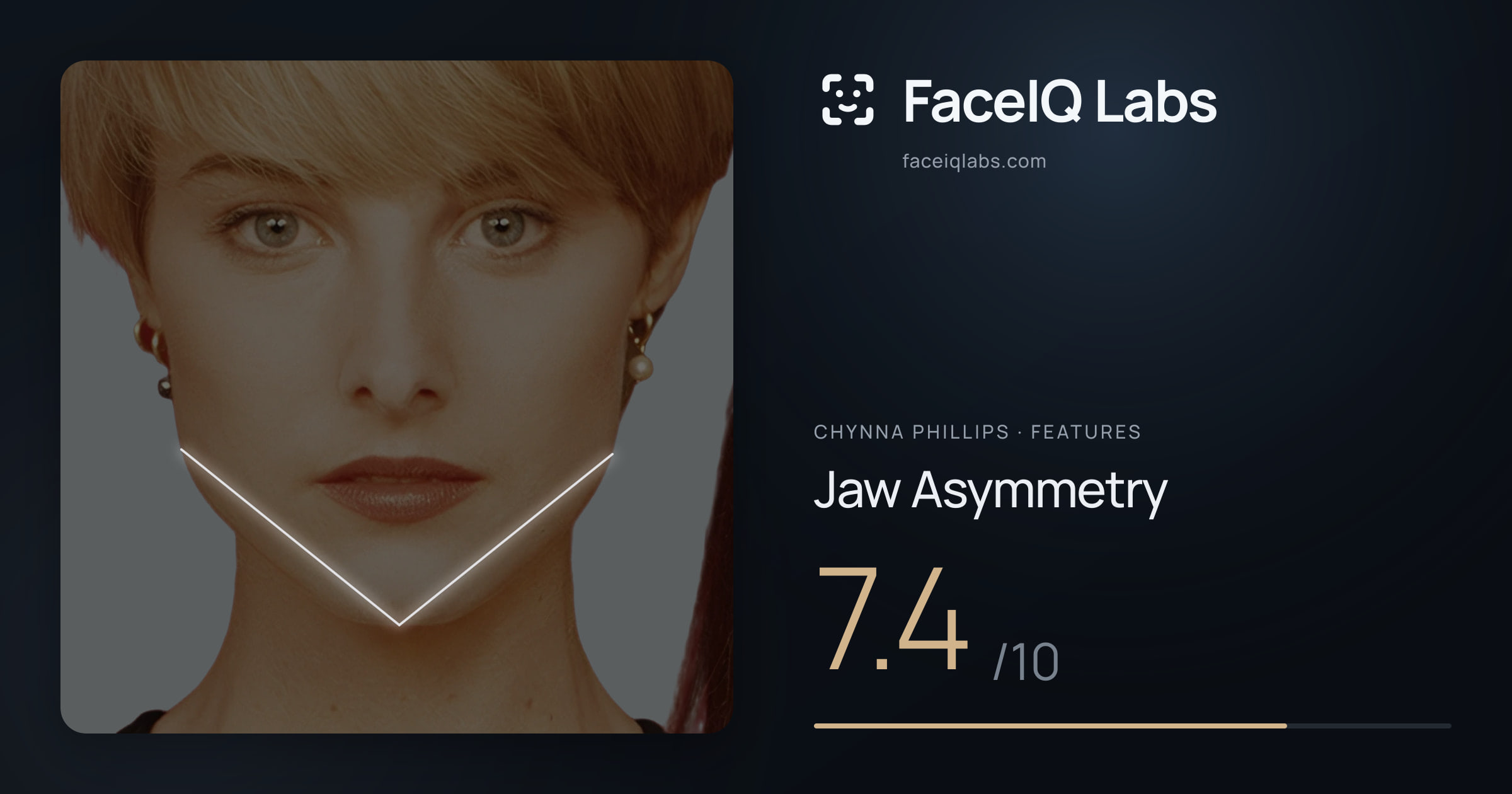 Chynna Phillips Jaw Asymmetry: 7.4/10, drawn on the photo