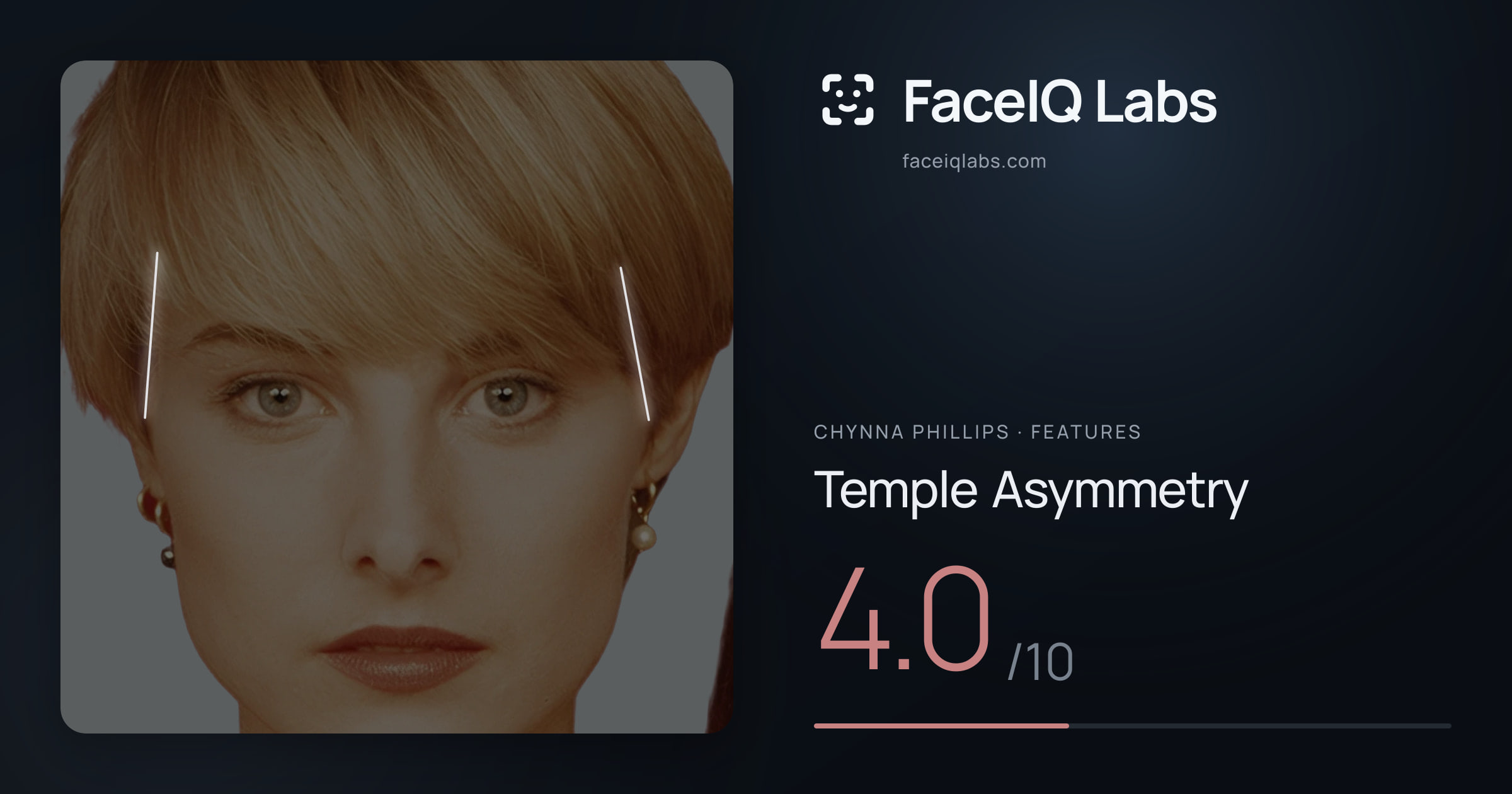 Chynna Phillips Temple Asymmetry: 4.0/10, drawn on the photo