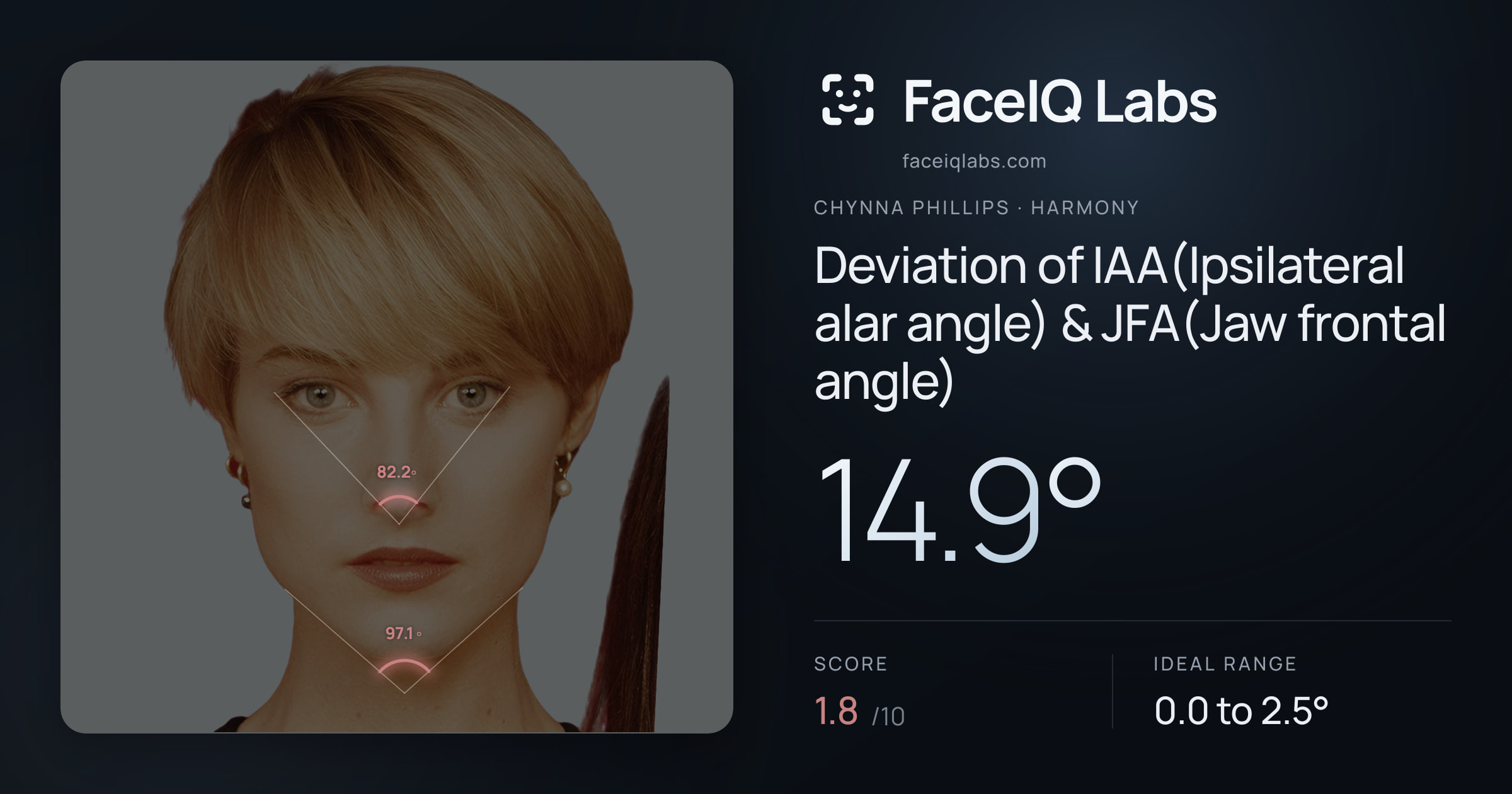 Chynna Phillips Deviation of IAA(Ipsilateral alar angle) & JFA(Jaw frontal angle): 14.9°, drawn on the photo
