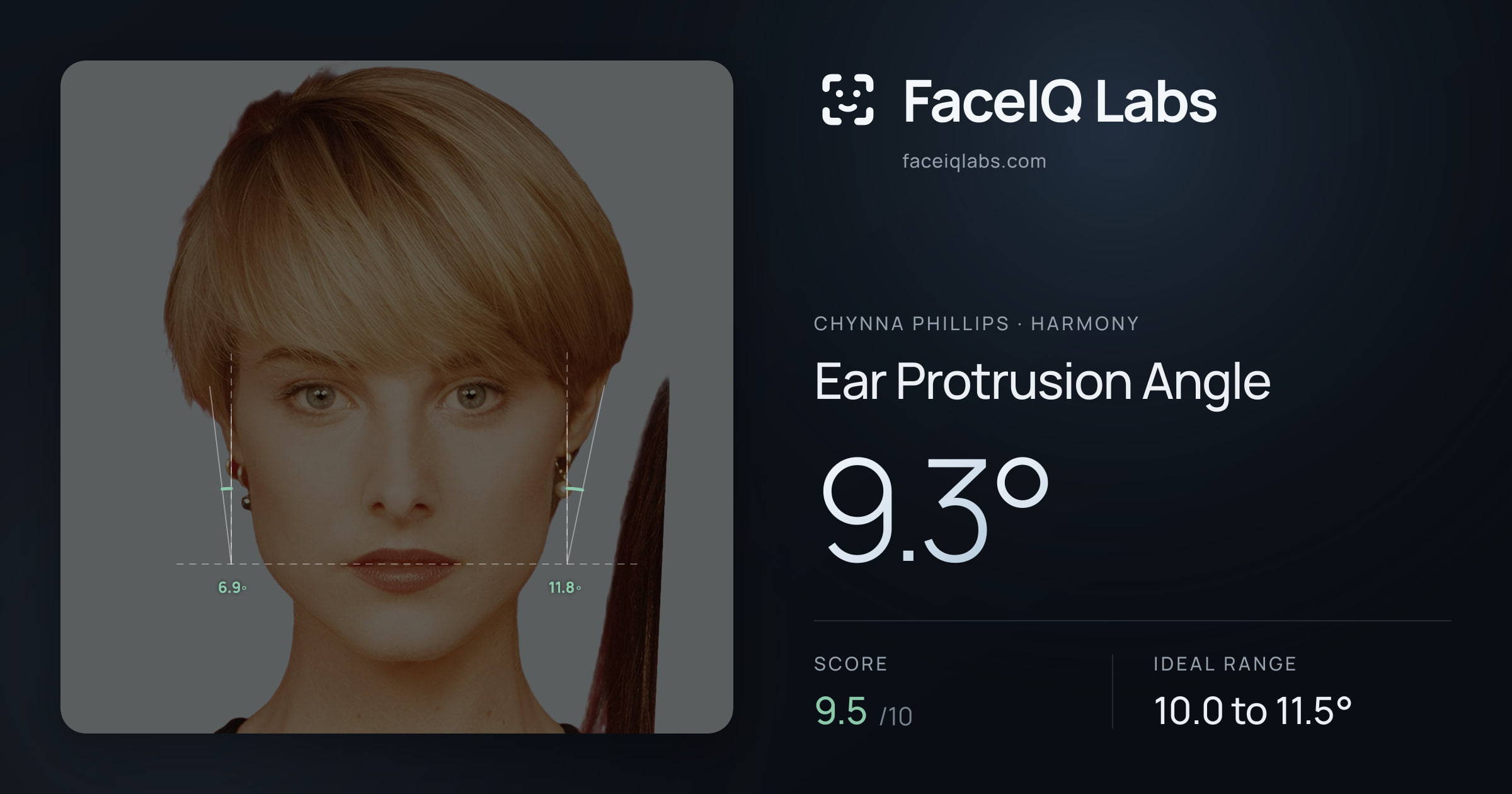 Chynna Phillips Ear Protrusion Angle: 9.3°, drawn on the photo