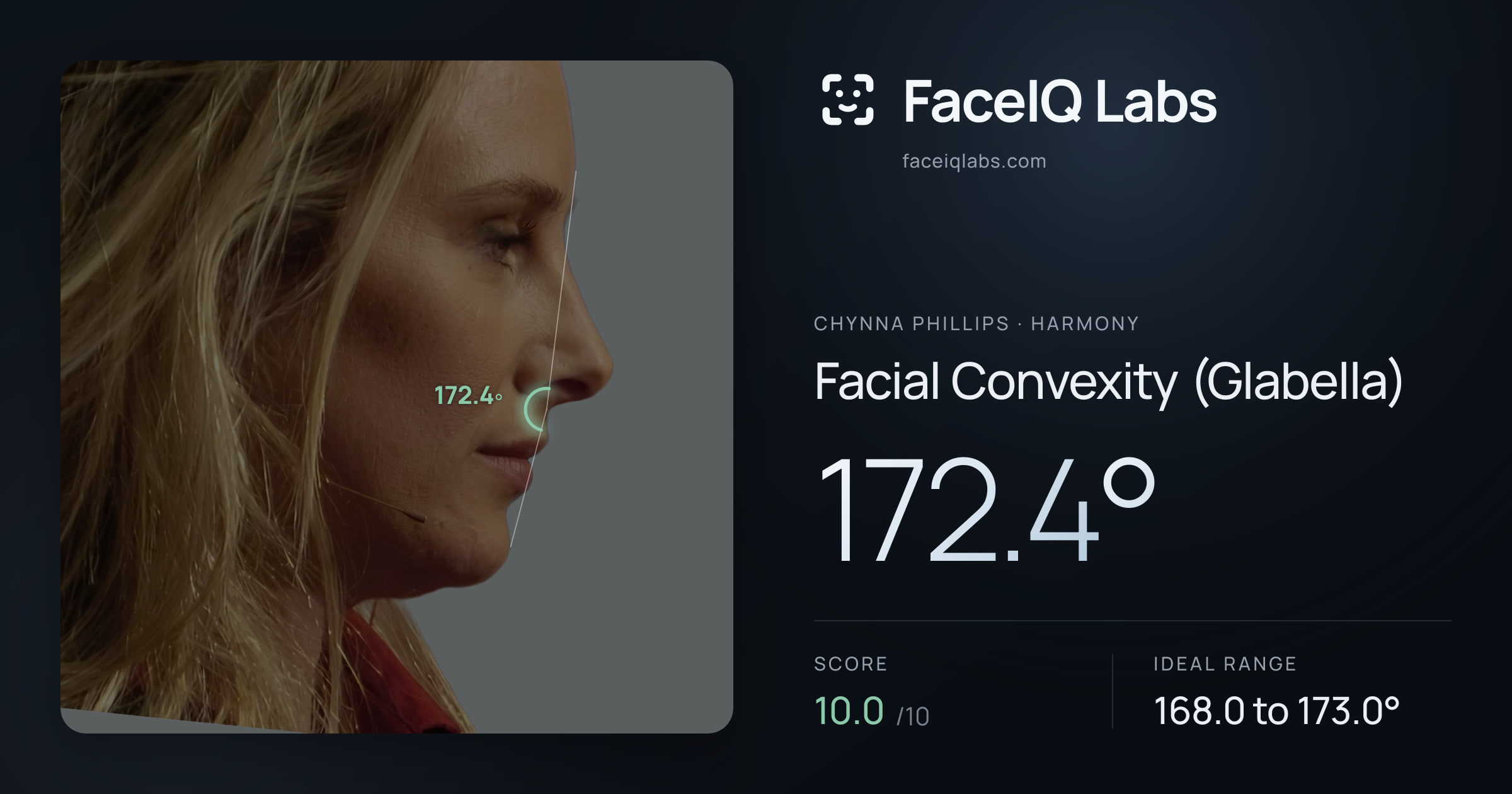 Chynna Phillips Facial Convexity (Glabella): 172.4°, drawn on the photo