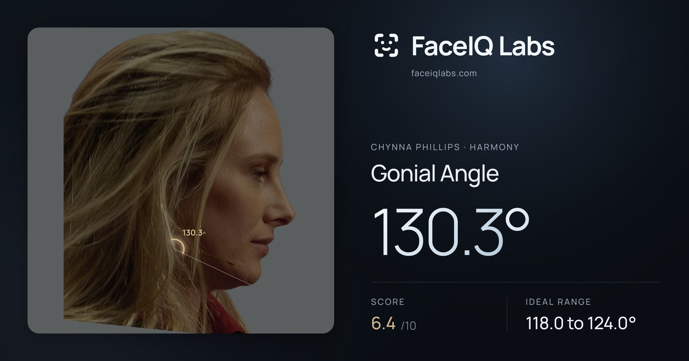 Chynna Phillips Gonial Angle: 130.3°, drawn on the photo