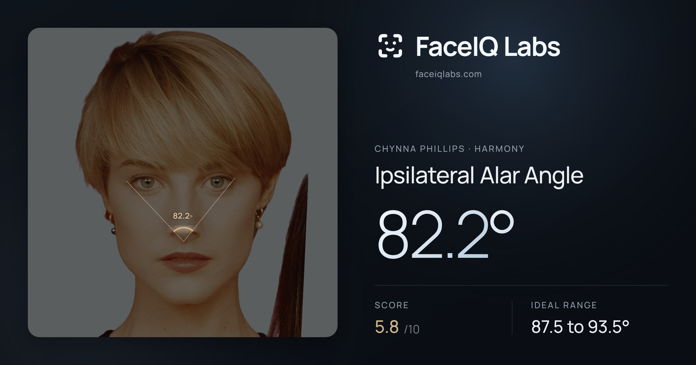 Chynna Phillips Ipsilateral Alar Angle: 82.2°, drawn on the photo