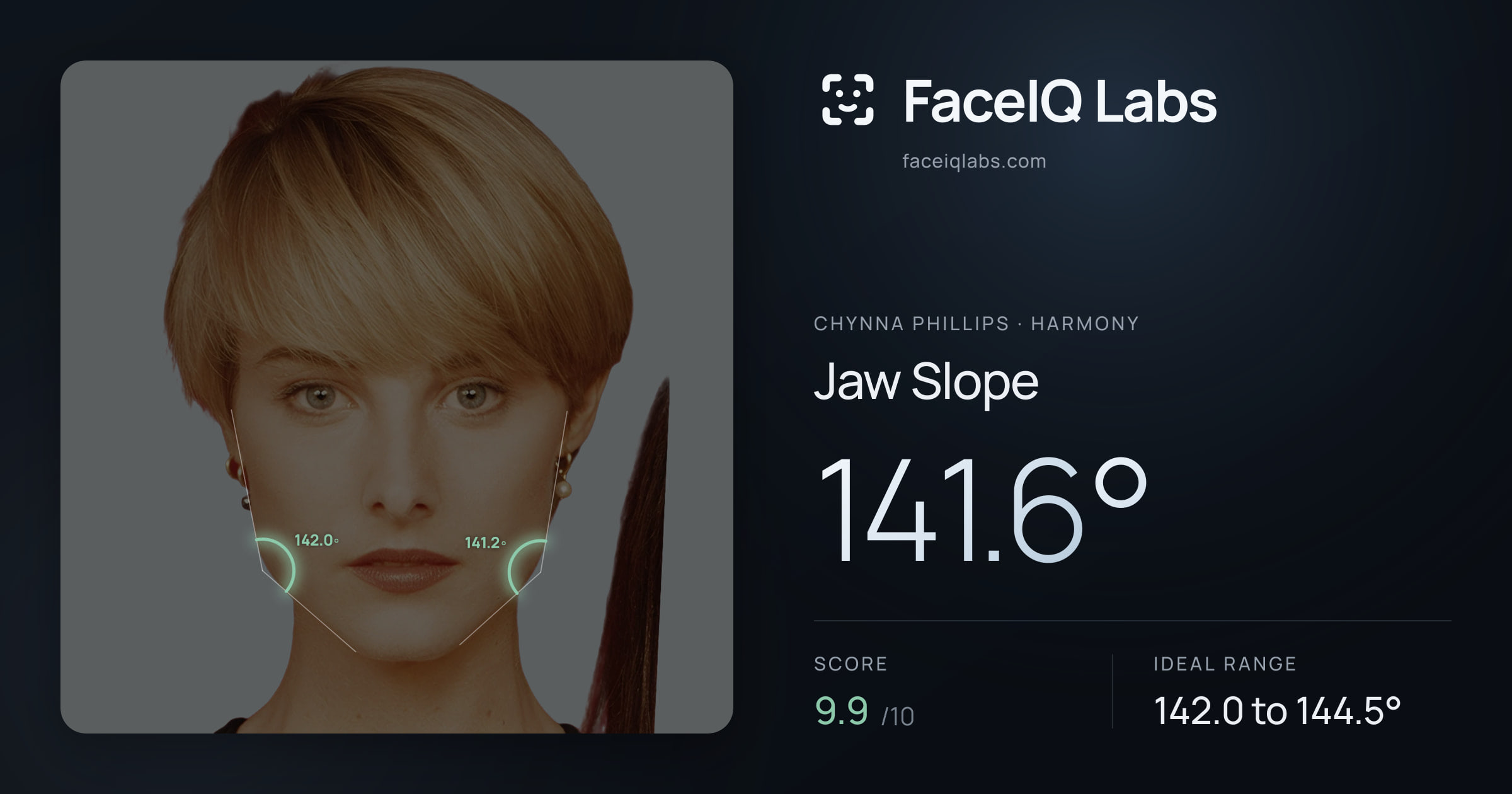 Chynna Phillips Jaw Slope: 141.6°, drawn on the photo