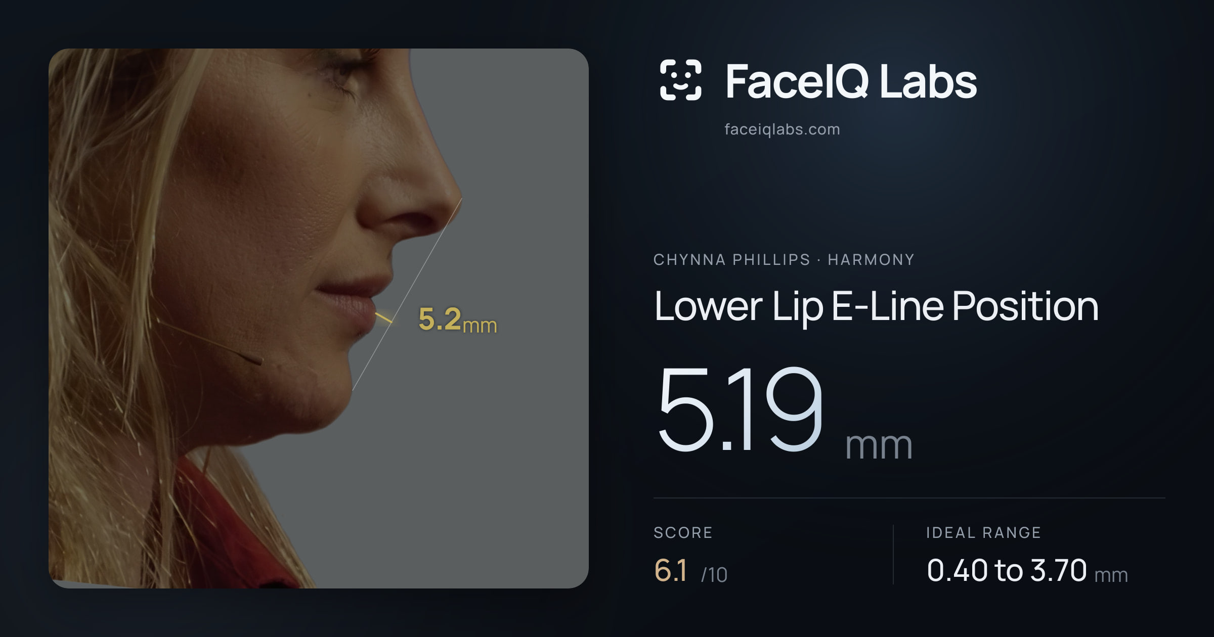Chynna Phillips Lower Lip E-Line Position: 5.19mm, drawn on the photo