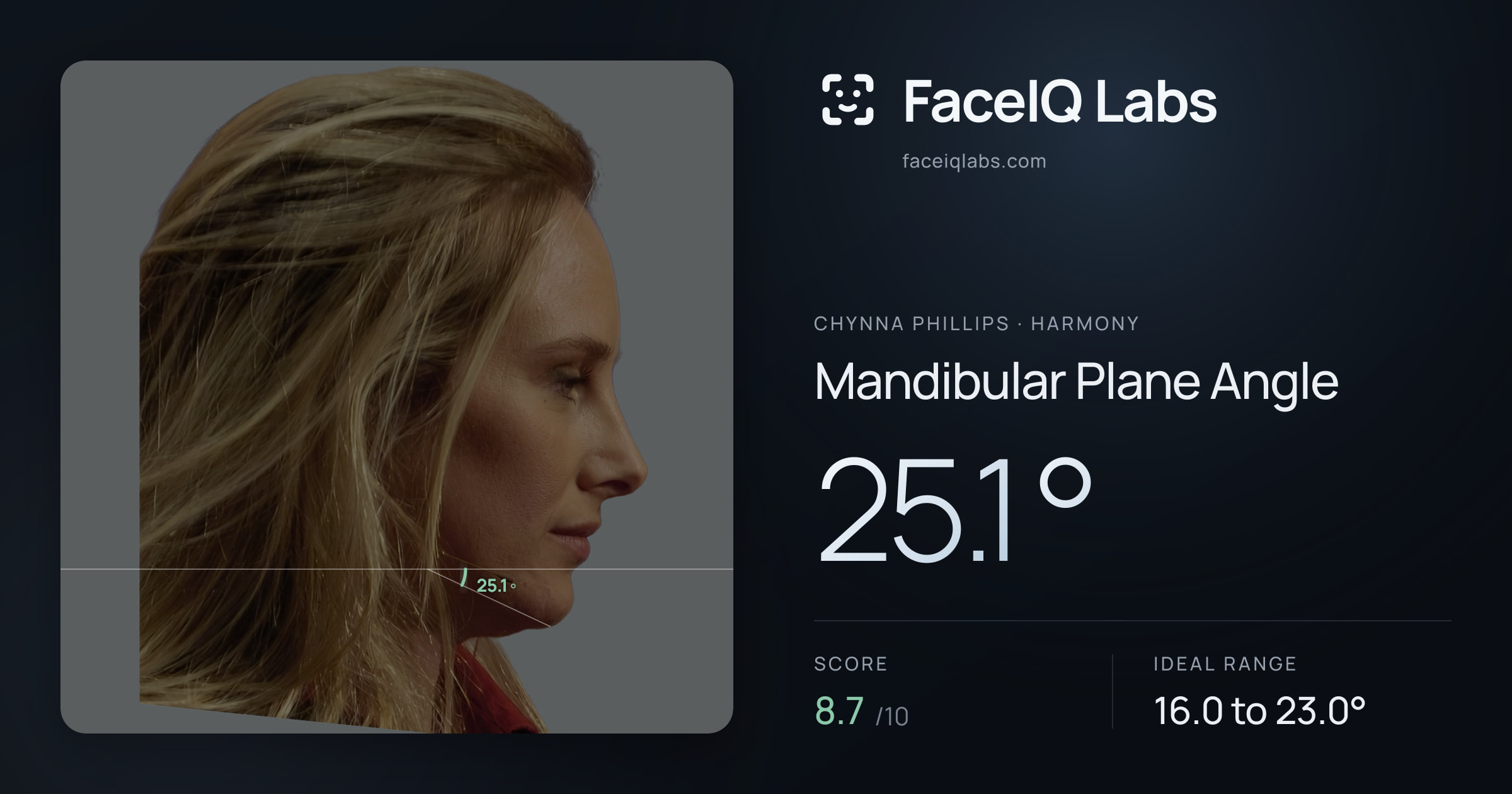 Chynna Phillips Mandibular Plane Angle: 25.1°, drawn on the photo
