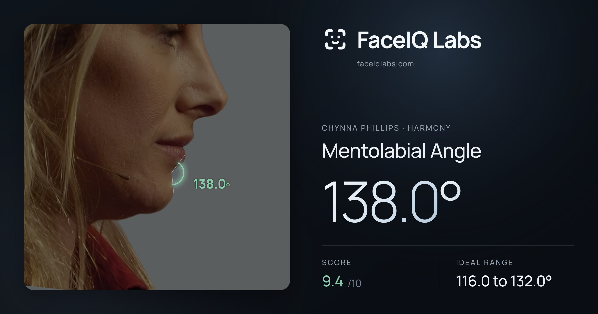 Chynna Phillips Mentolabial Angle: 138.0°, drawn on the photo