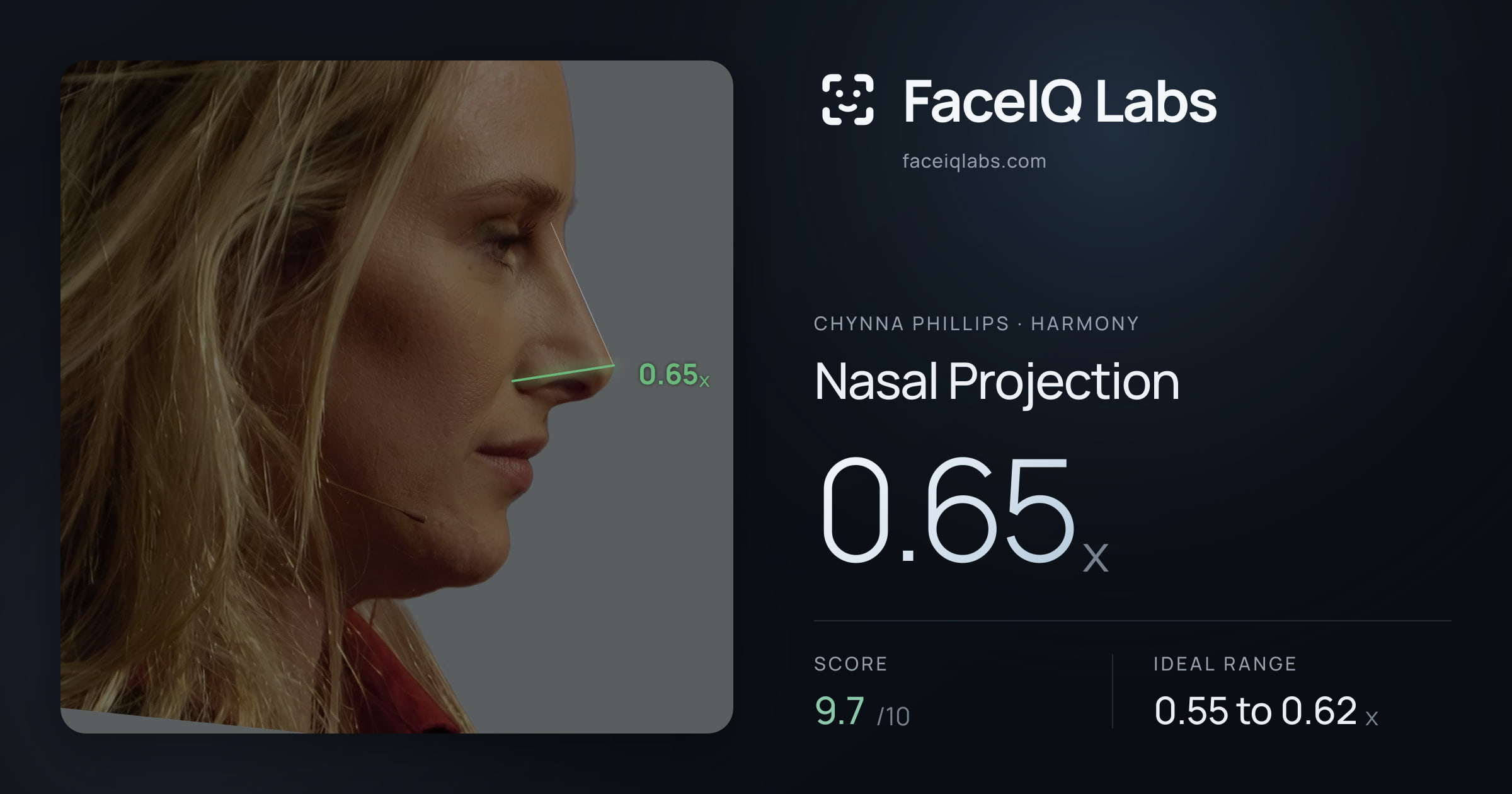 Chynna Phillips Nasal Projection: 0.65x, drawn on the photo
