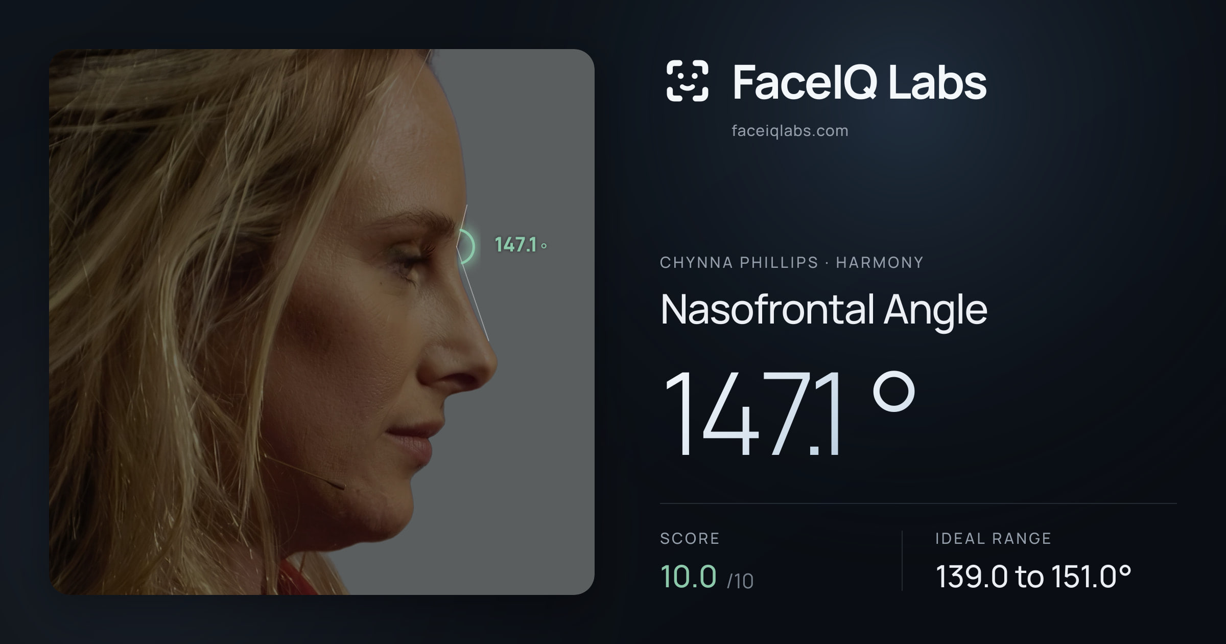 Chynna Phillips Nasofrontal Angle: 147.1°, drawn on the photo