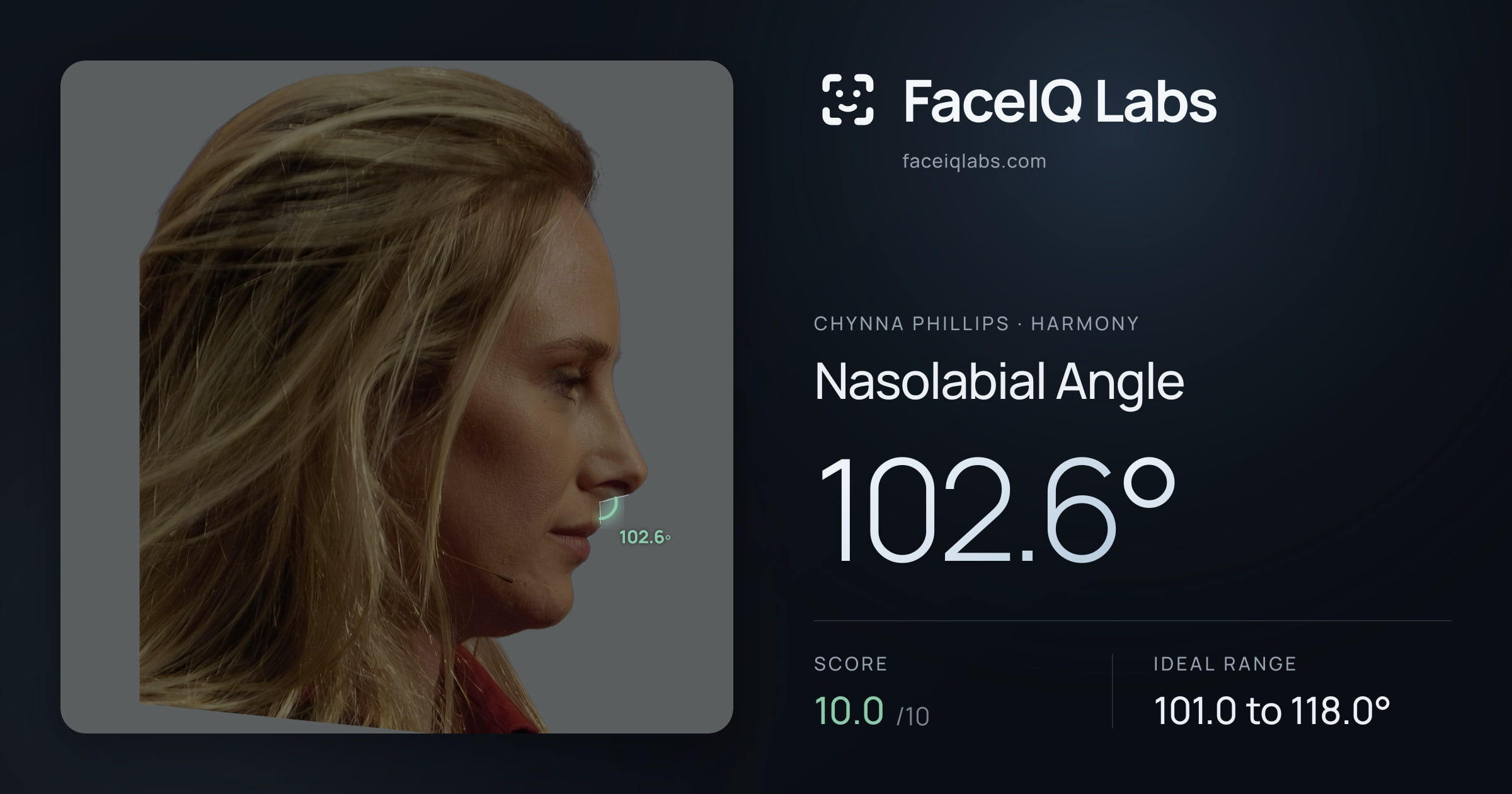 Chynna Phillips Nasolabial Angle: 102.6°, drawn on the photo