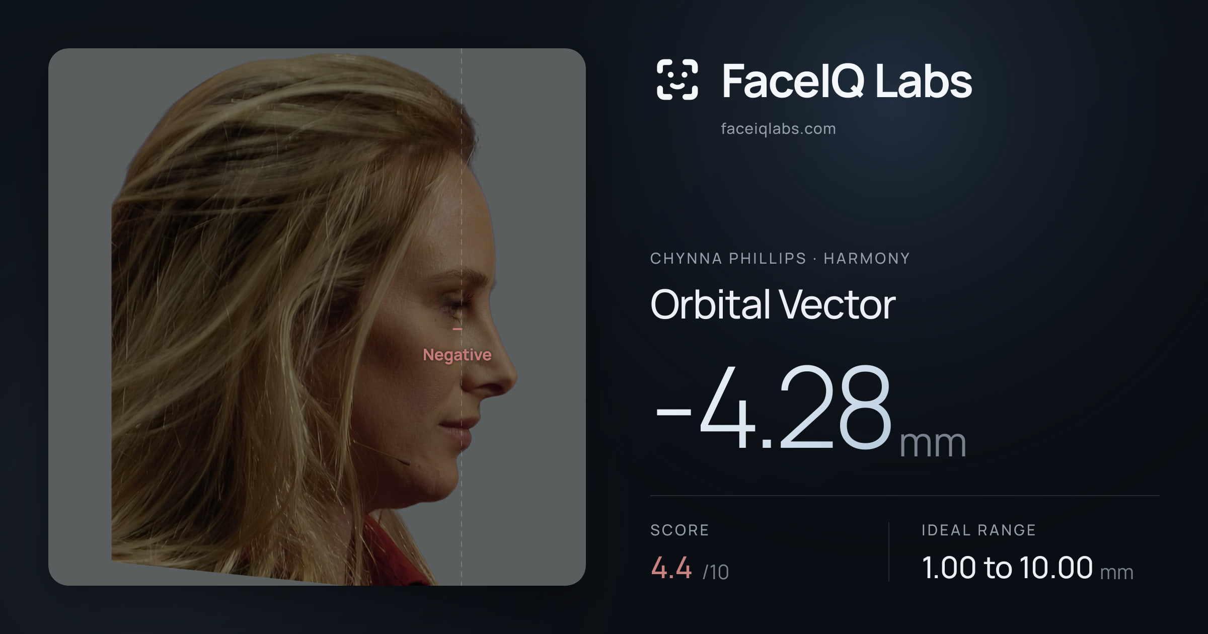 Chynna Phillips Orbital Vector: -4.28mm, drawn on the photo