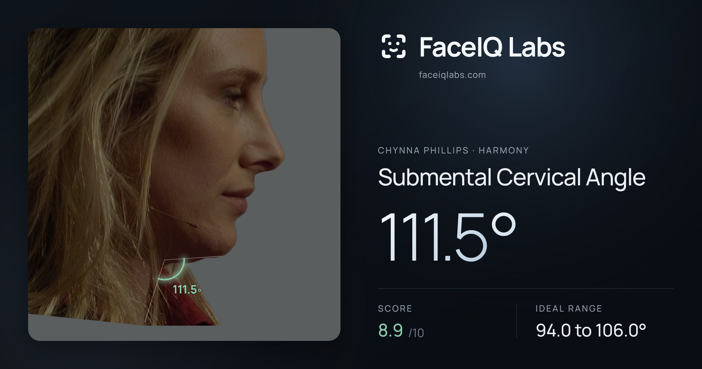 Chynna Phillips Submental Cervical Angle: 111.5°, drawn on the photo