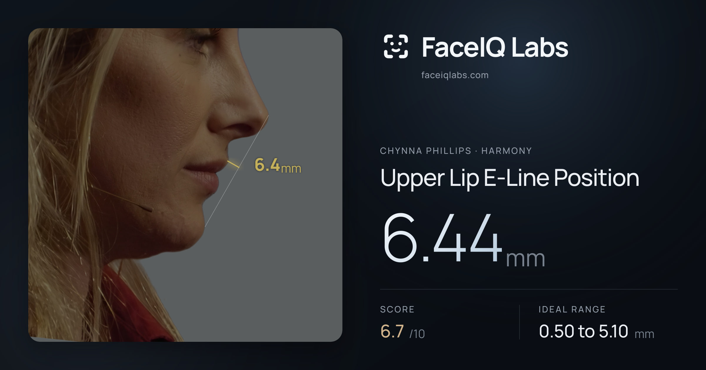 Chynna Phillips Upper Lip E-Line Position: 6.44mm, drawn on the photo