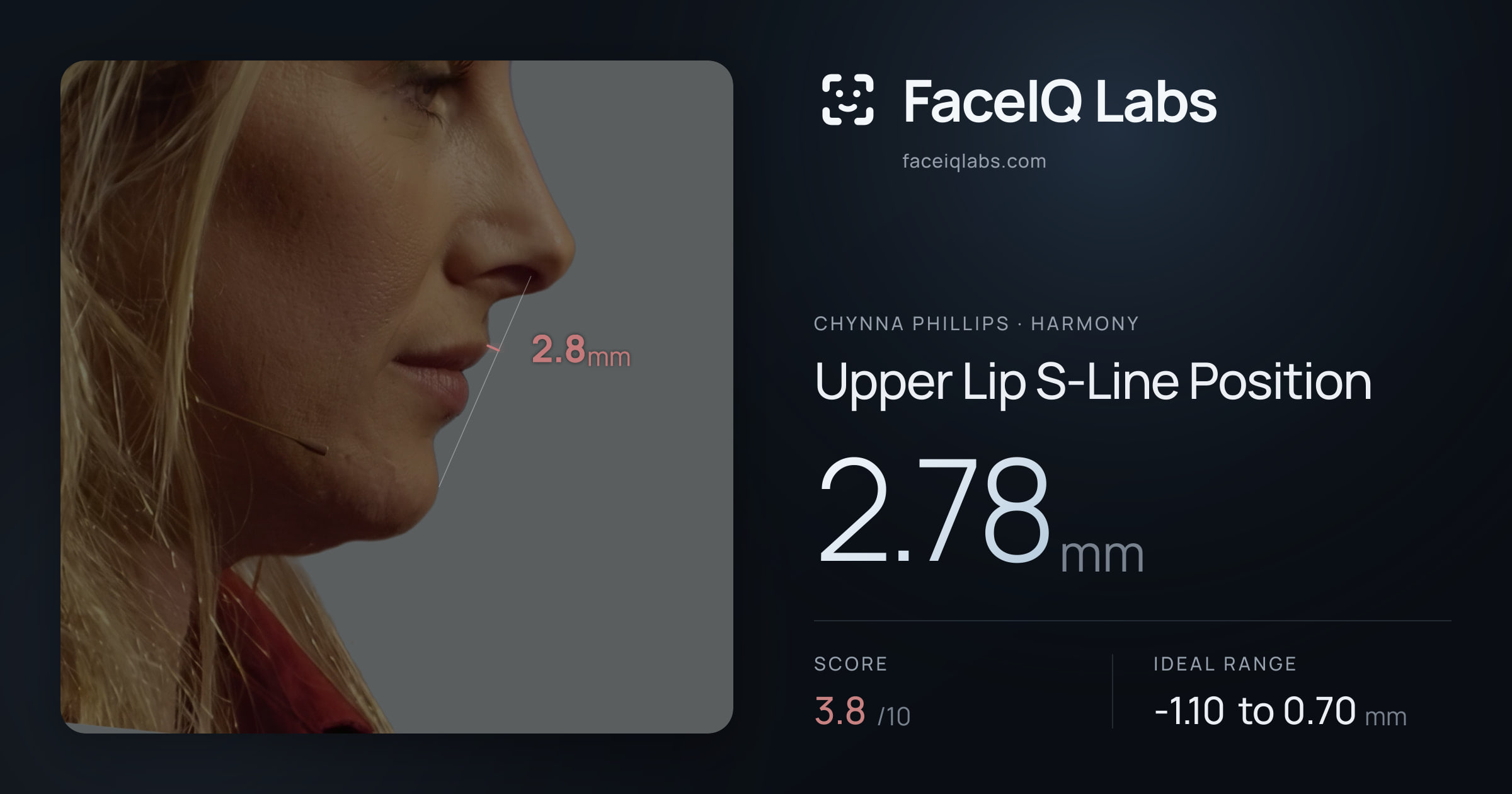 Chynna Phillips Upper Lip S-Line Position: 2.78mm, drawn on the photo