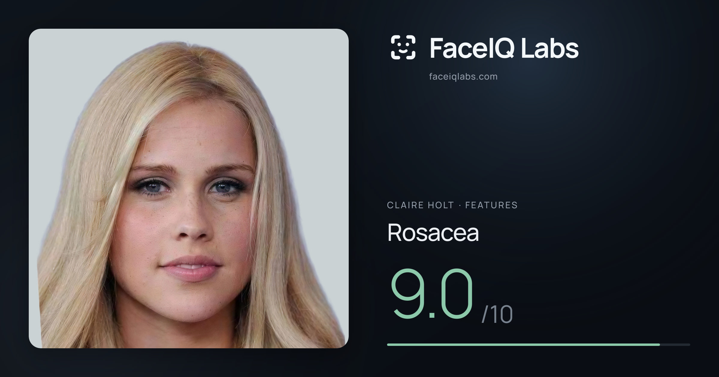 Claire Holt Rosacea: 9.0/10, drawn on the photo