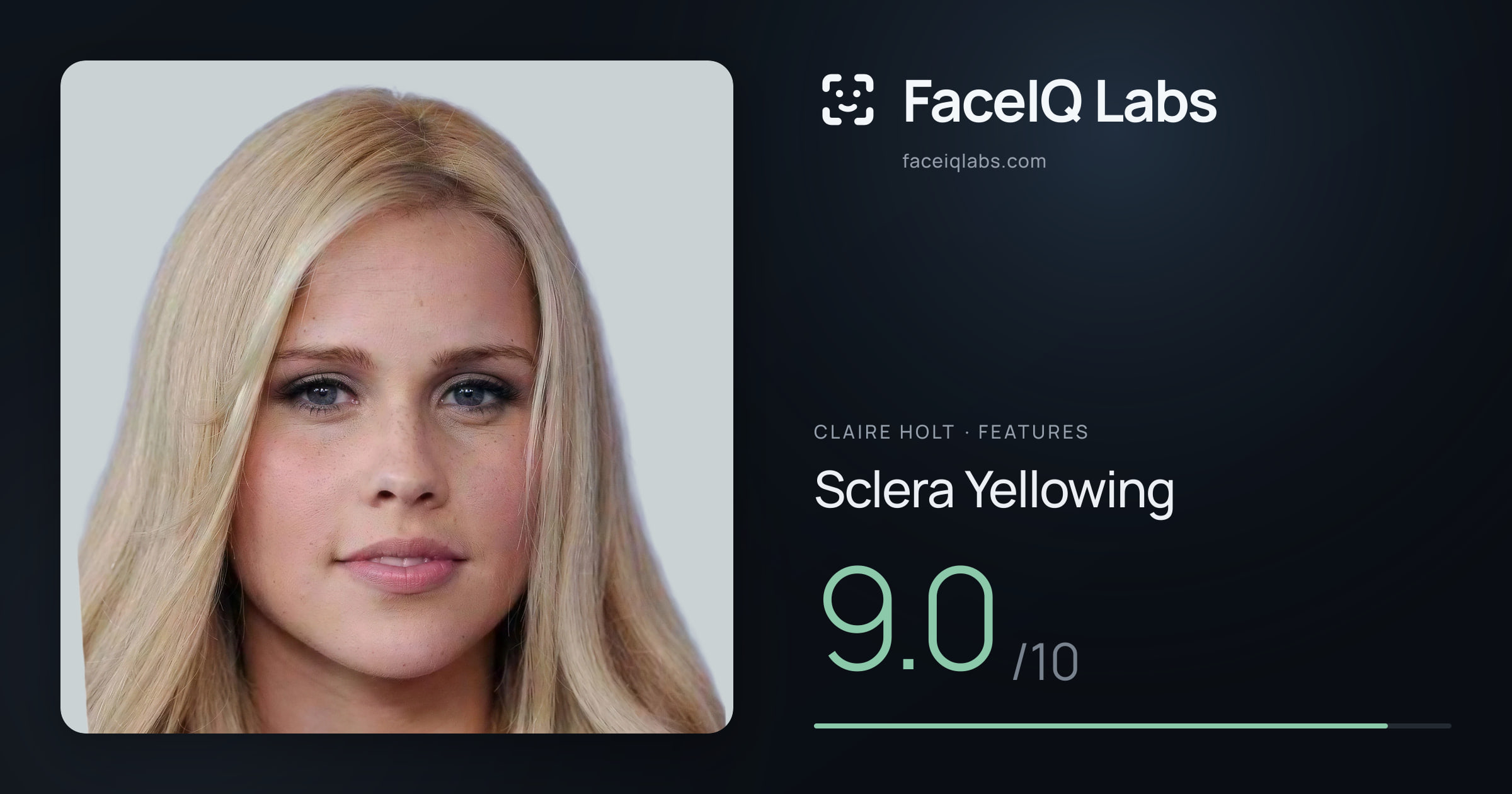 Claire Holt Sclera Yellowing: 9.0/10, drawn on the photo