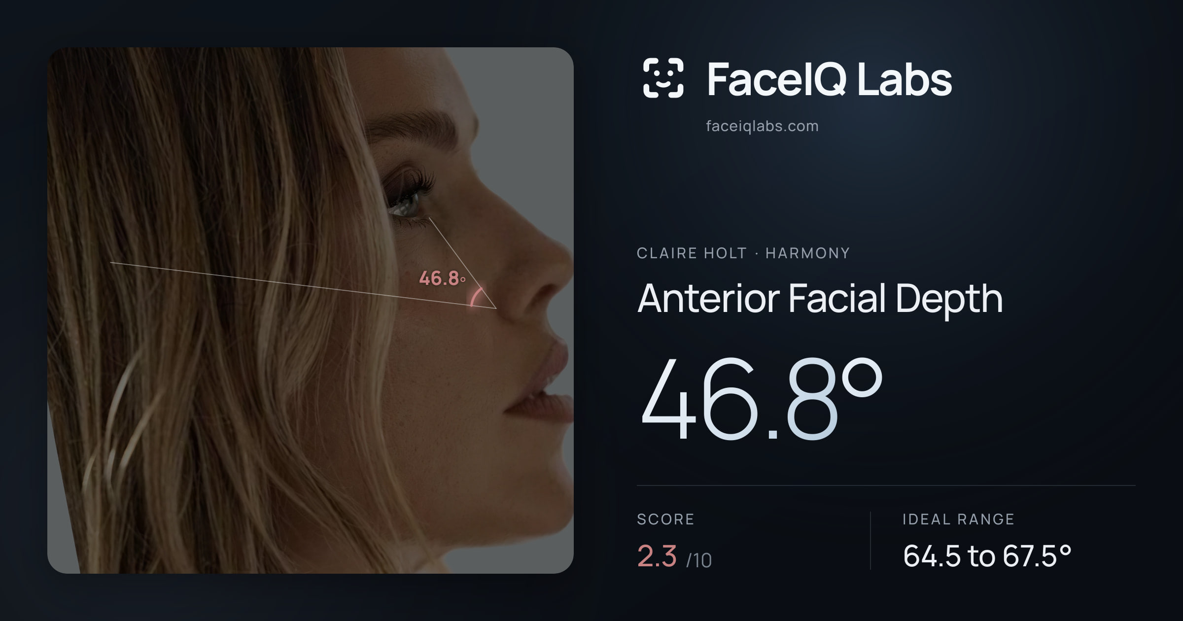 Claire Holt Anterior Facial Depth: 46.8°, drawn on the photo
