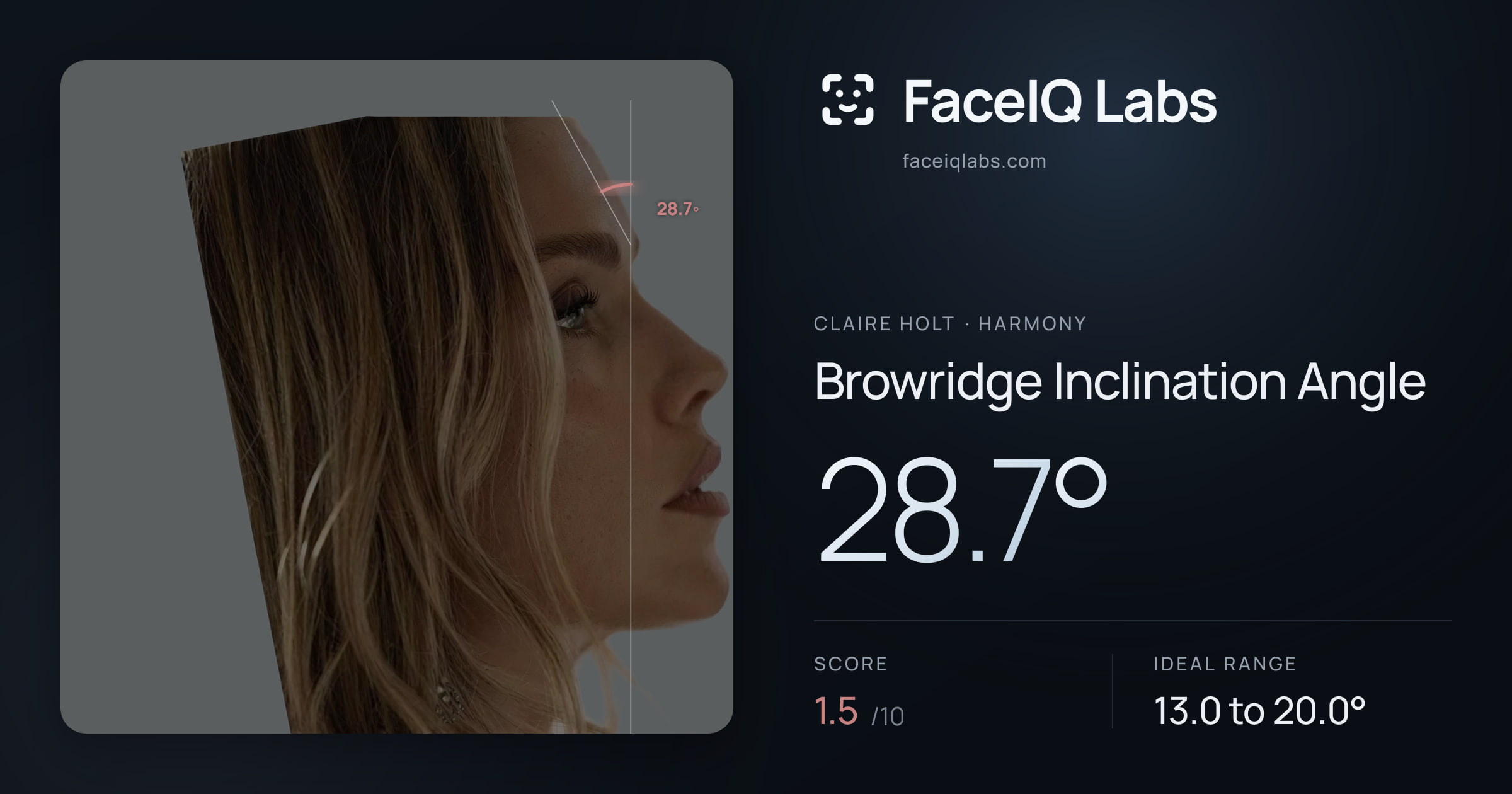 Claire Holt Browridge Inclination Angle: 28.7°, drawn on the photo