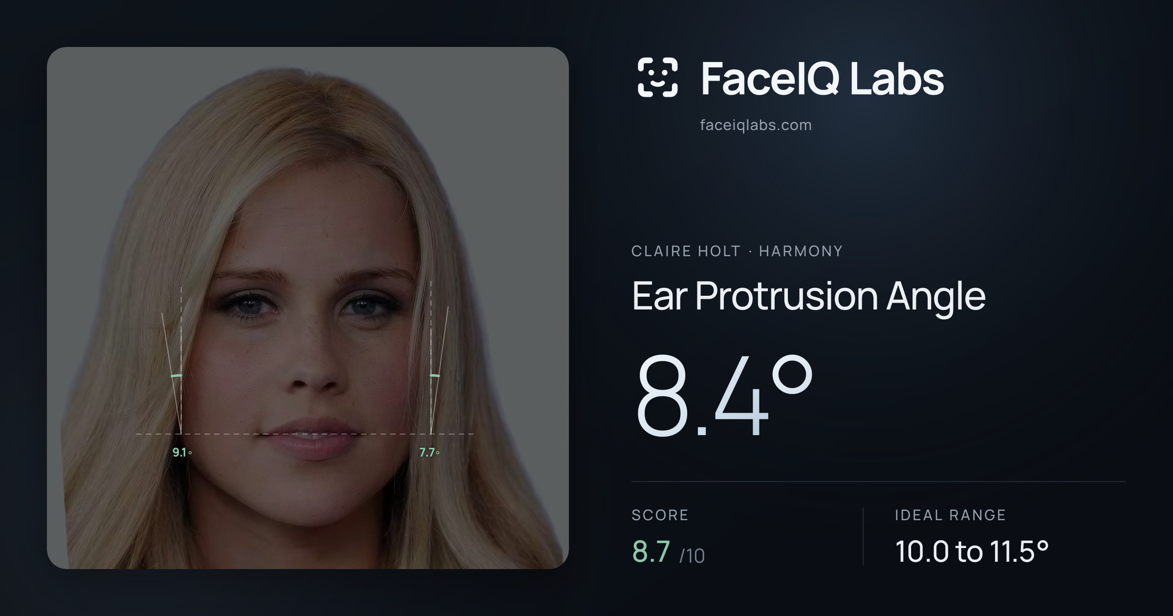 Claire Holt Ear Protrusion Angle: 8.4°, drawn on the photo