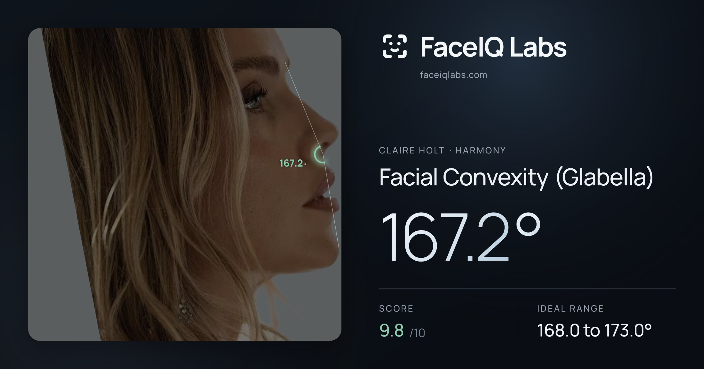 Claire Holt Facial Convexity (Glabella): 167.2°, drawn on the photo