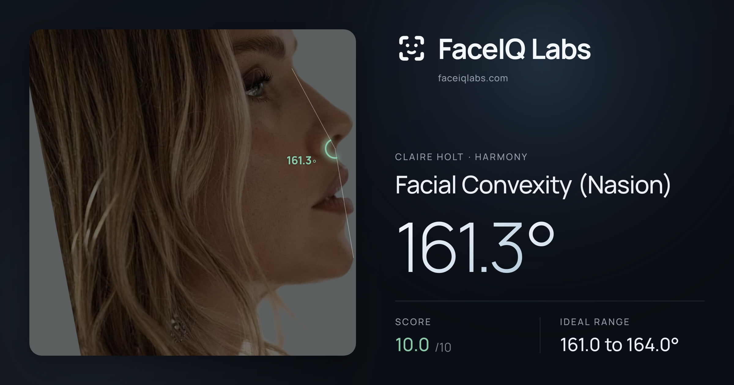 Claire Holt Facial Convexity (Nasion): 161.3°, drawn on the photo