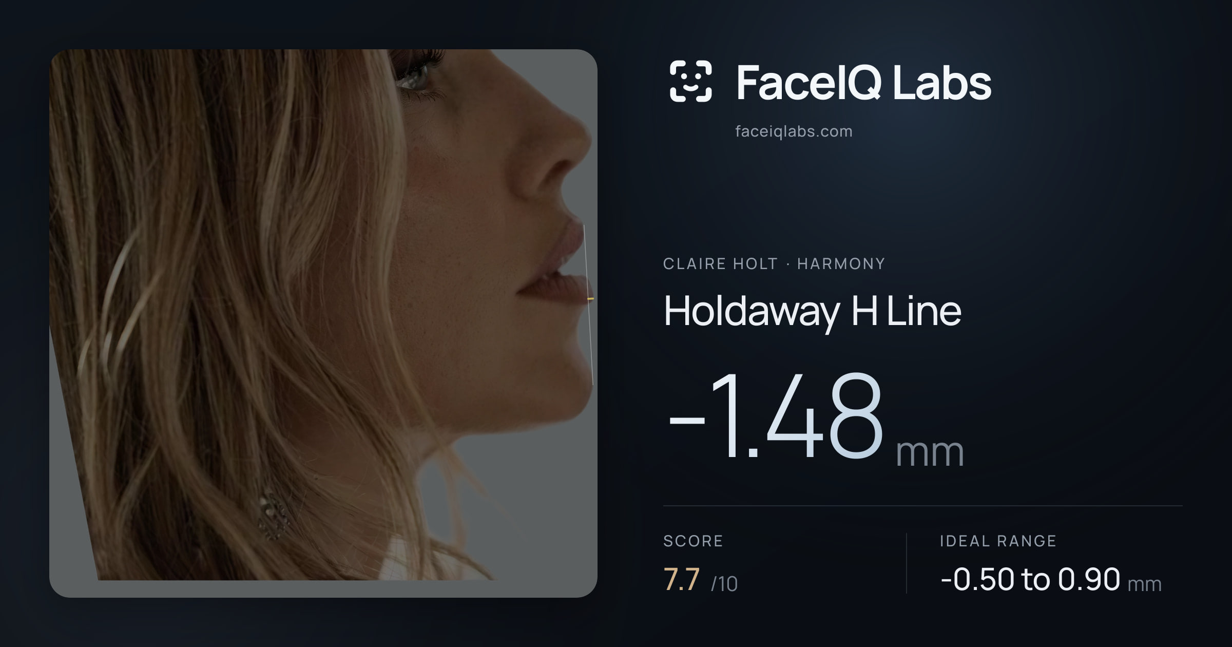 Claire Holt Holdaway H Line: -1.48mm, drawn on the photo