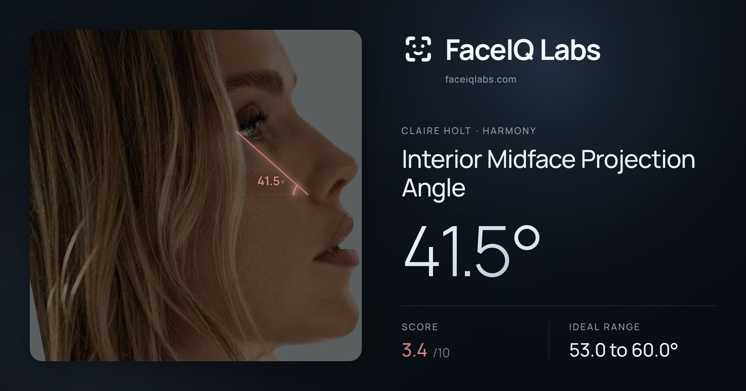 Claire Holt Interior Midface Projection Angle: 41.5°, drawn on the photo