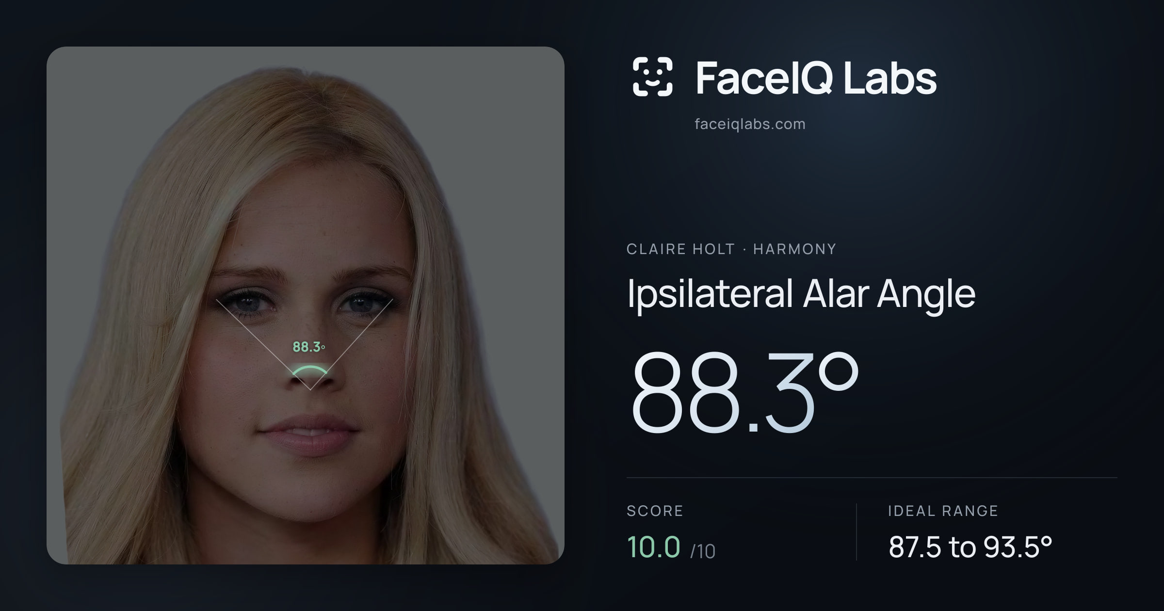 Claire Holt Ipsilateral Alar Angle: 88.3°, drawn on the photo