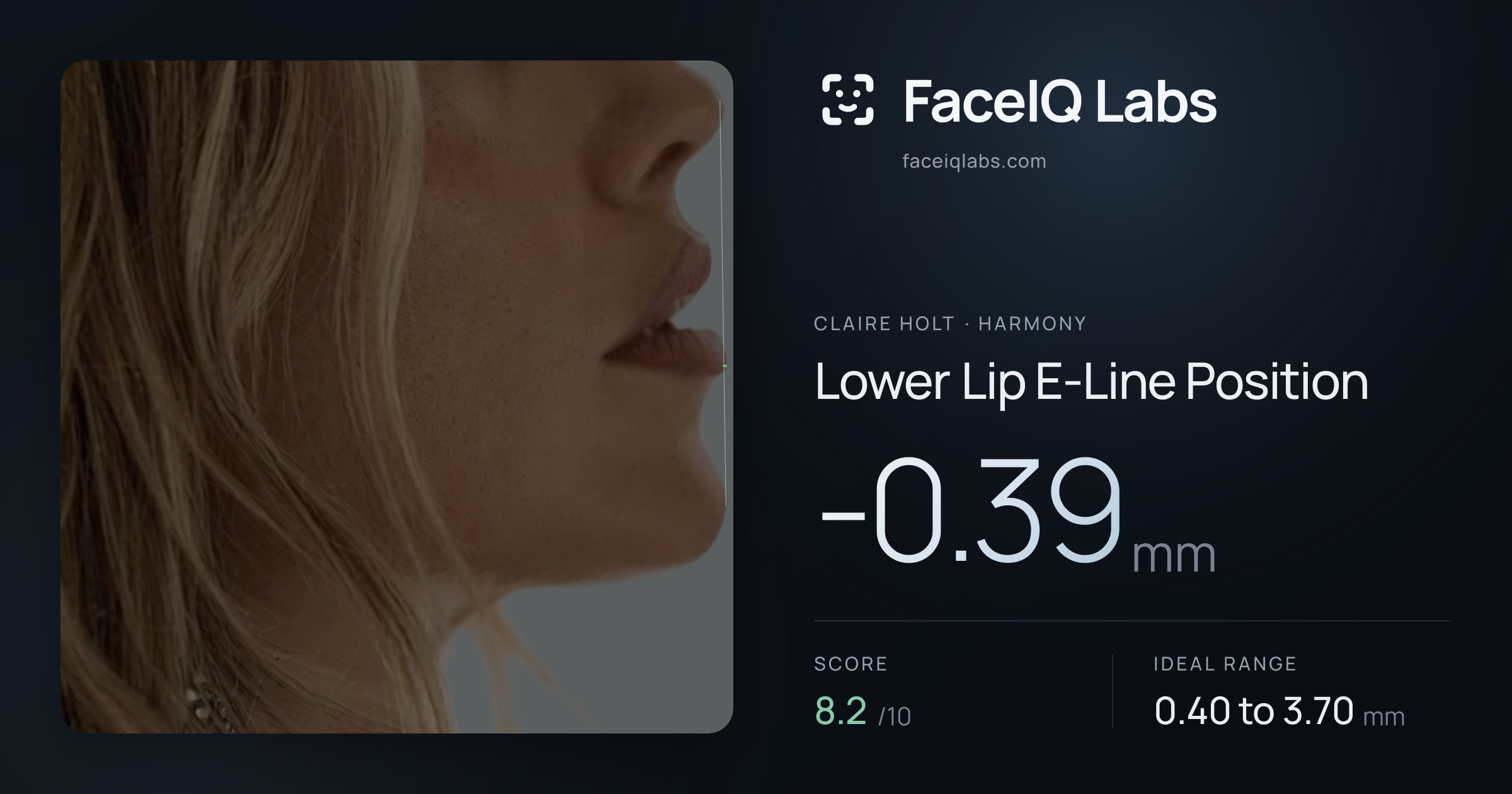 Claire Holt Lower Lip E-Line Position: -0.39mm, drawn on the photo