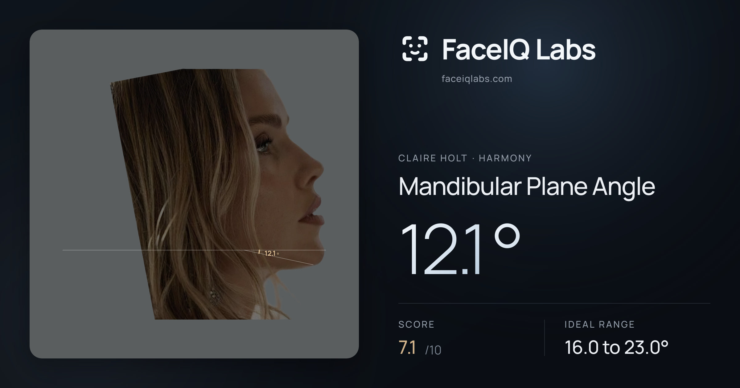 Claire Holt Mandibular Plane Angle: 12.1°, drawn on the photo