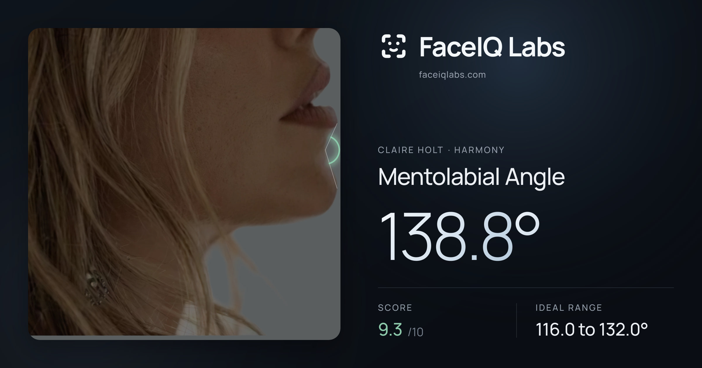 Claire Holt Mentolabial Angle: 138.8°, drawn on the photo
