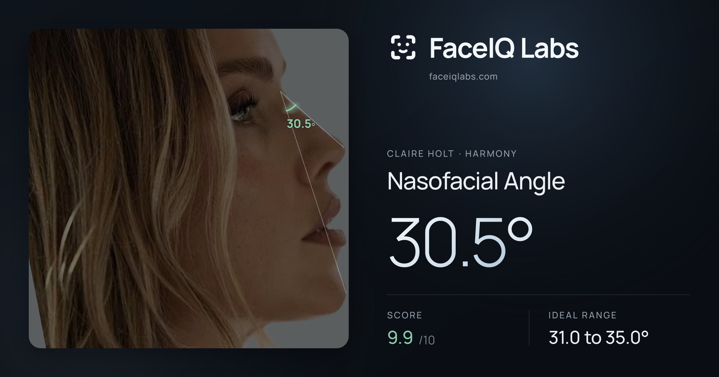 Claire Holt Nasofacial Angle: 30.5°, drawn on the photo