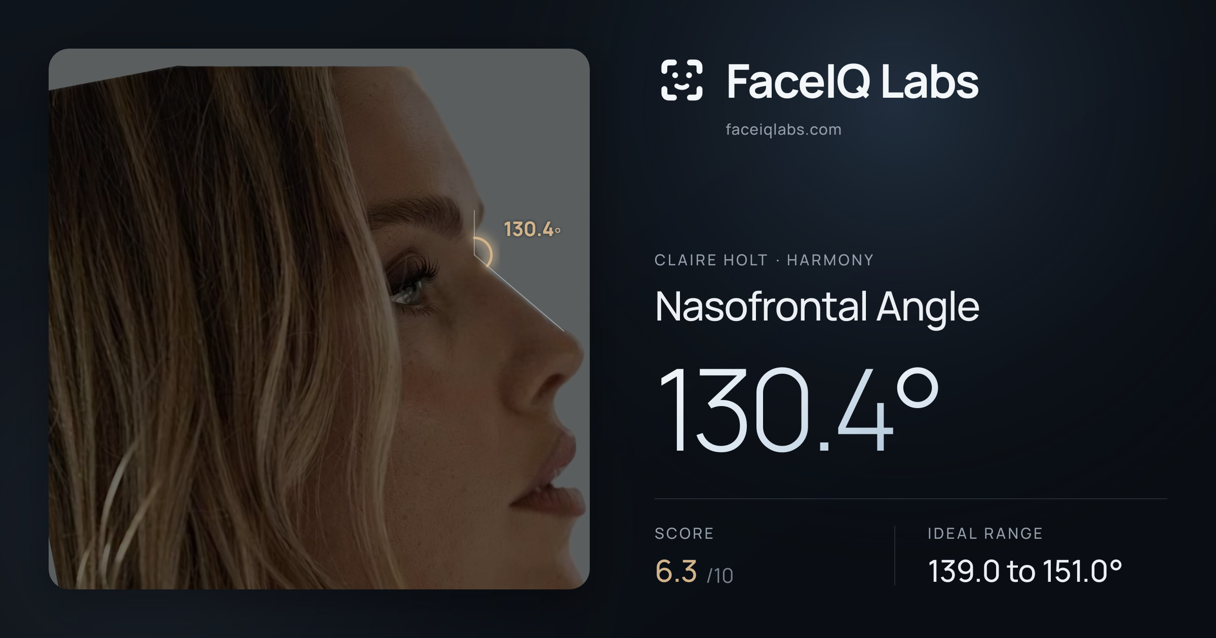 Claire Holt Nasofrontal Angle: 130.4°, drawn on the photo