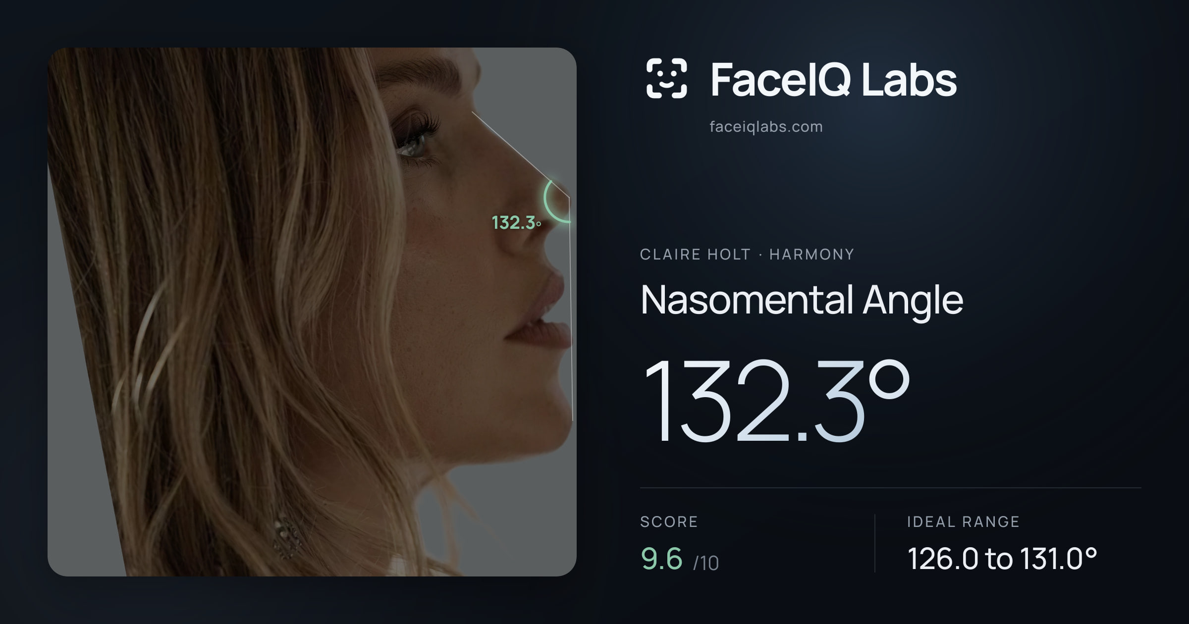 Claire Holt Nasomental Angle: 132.3°, drawn on the photo