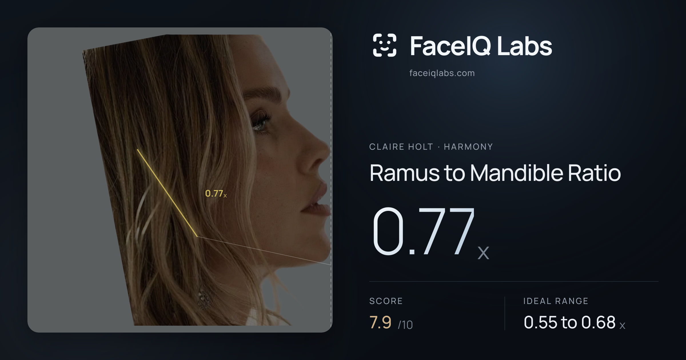 Claire Holt Ramus to Mandible Ratio: 0.77x, drawn on the photo