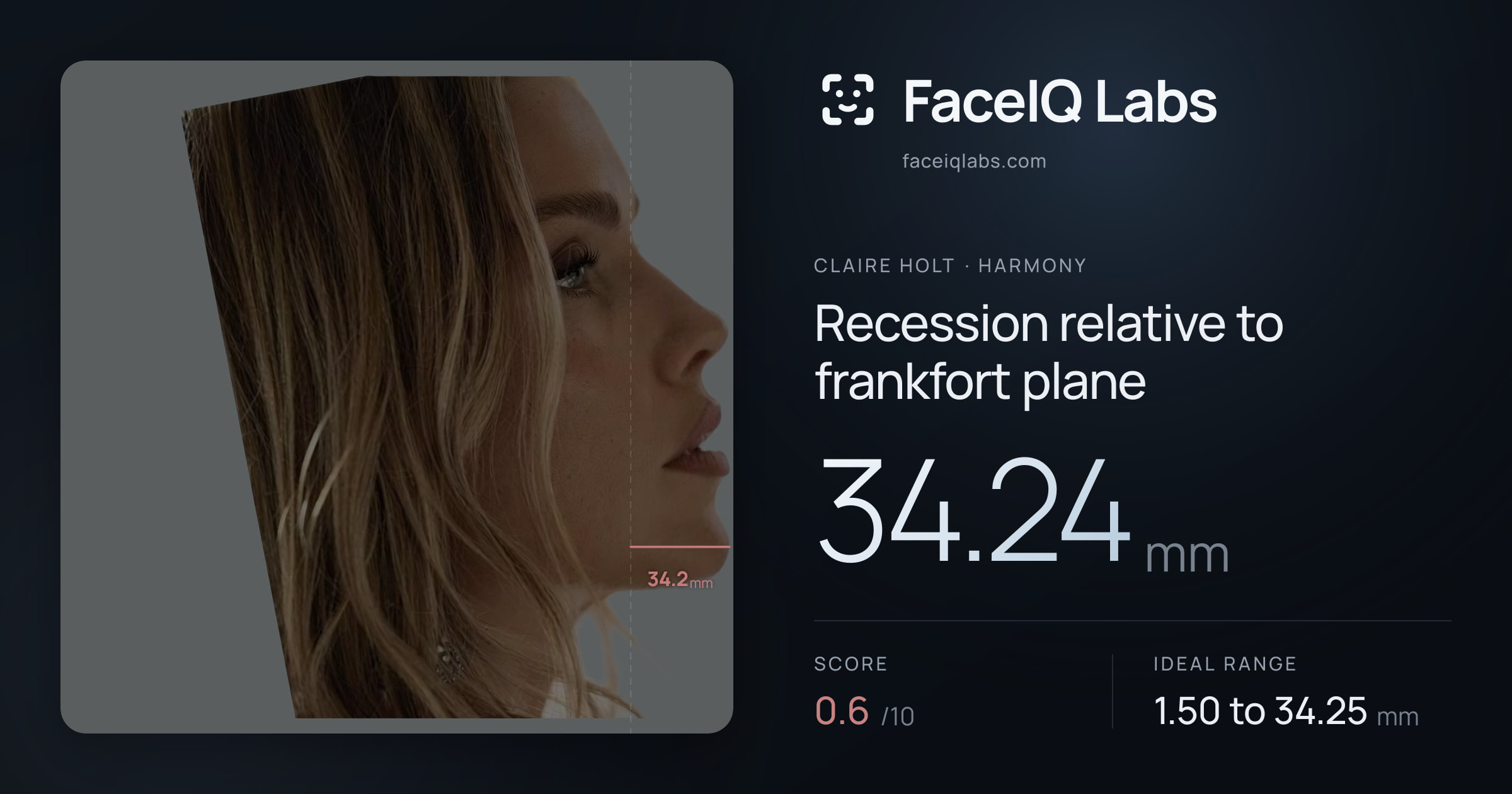 Claire Holt Recession relative to frankfort plane: 34.24mm, drawn on the photo