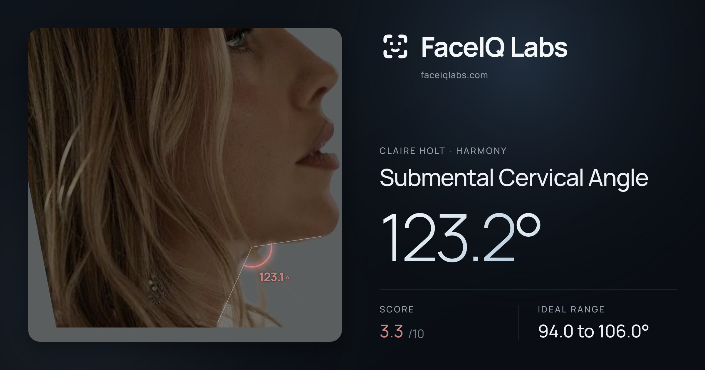 Claire Holt Submental Cervical Angle: 123.2°, drawn on the photo