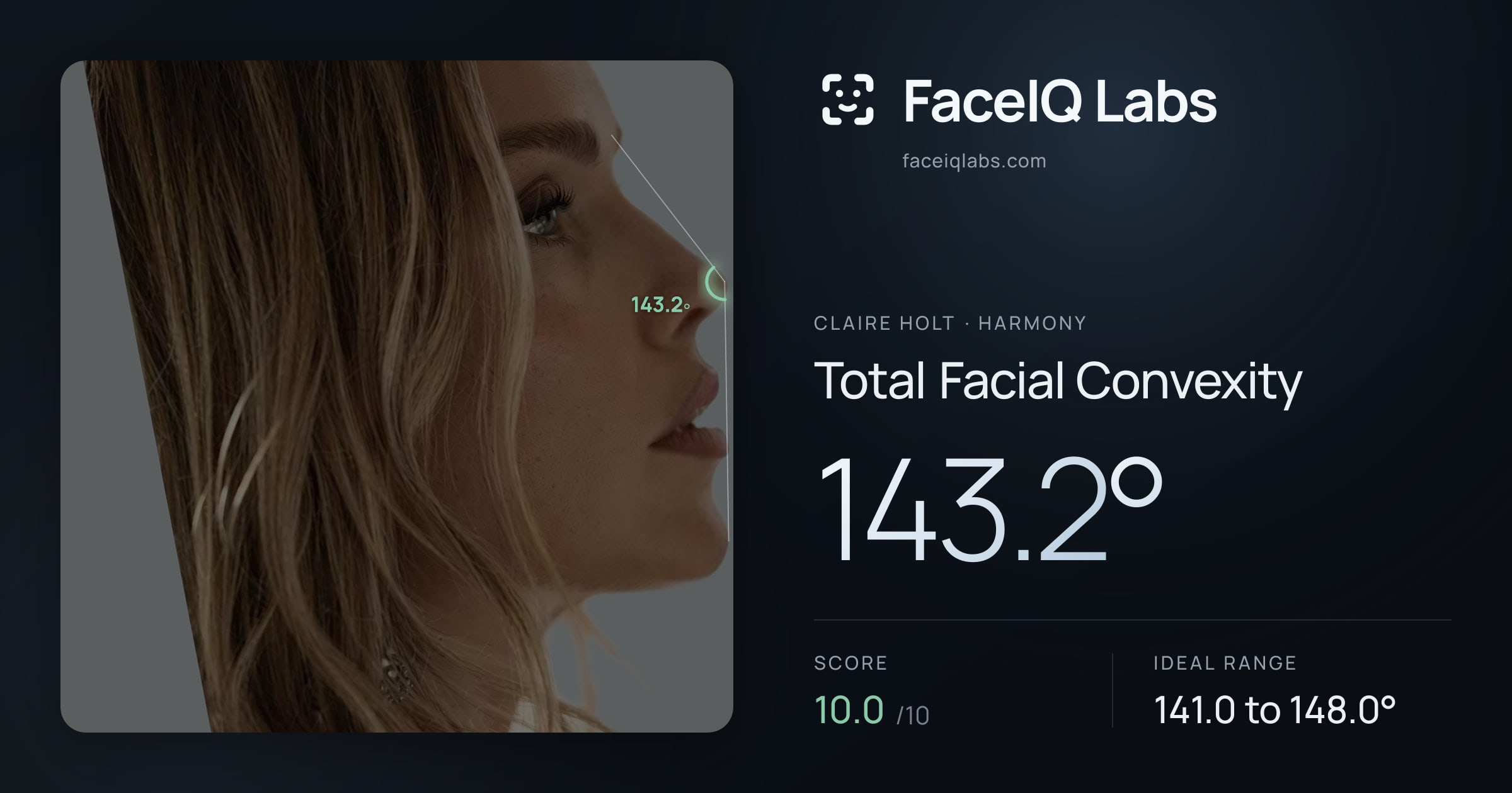 Claire Holt Total Facial Convexity: 143.2°, drawn on the photo