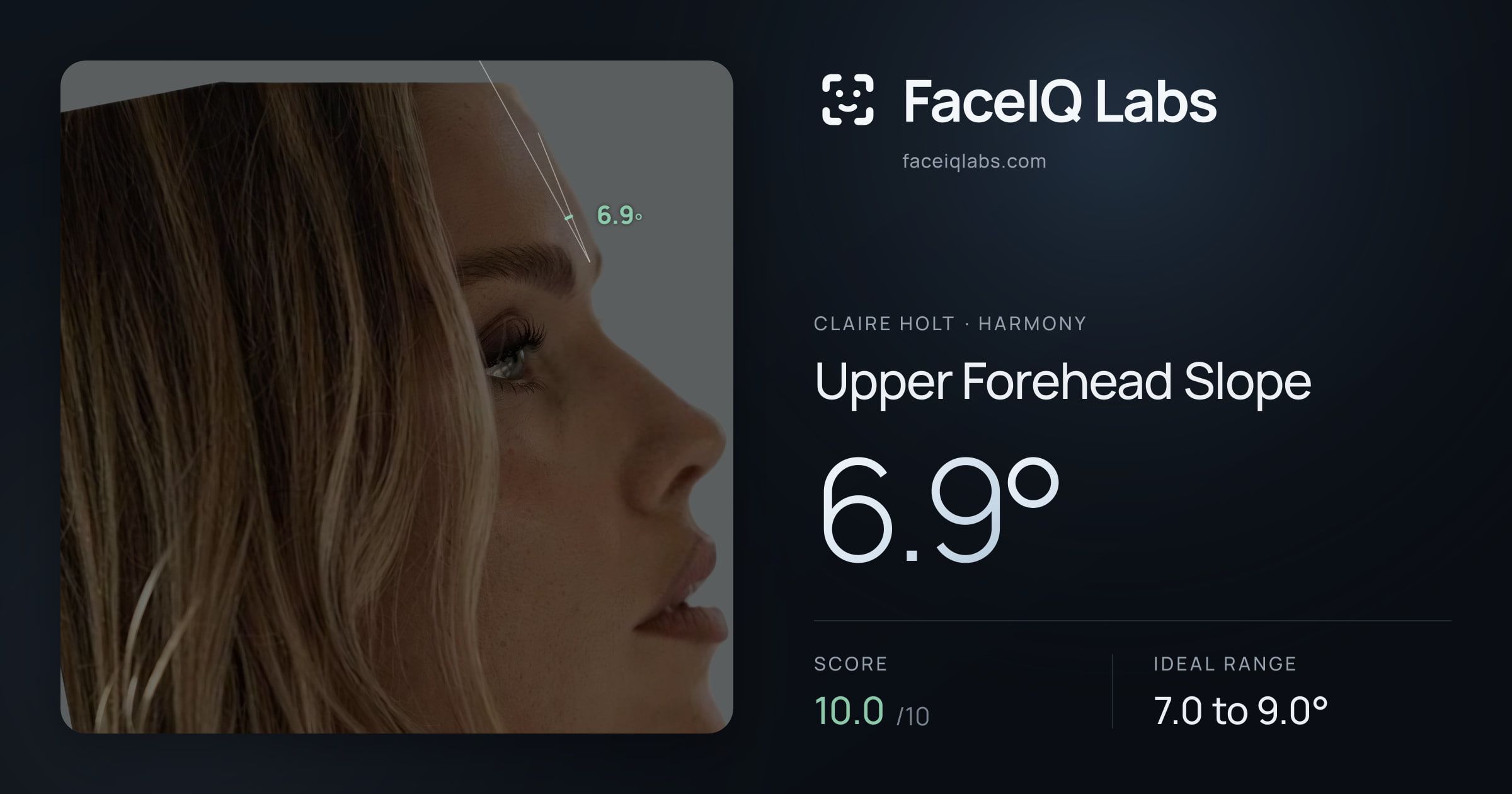 Claire Holt Upper Forehead Slope: 6.9°, drawn on the photo