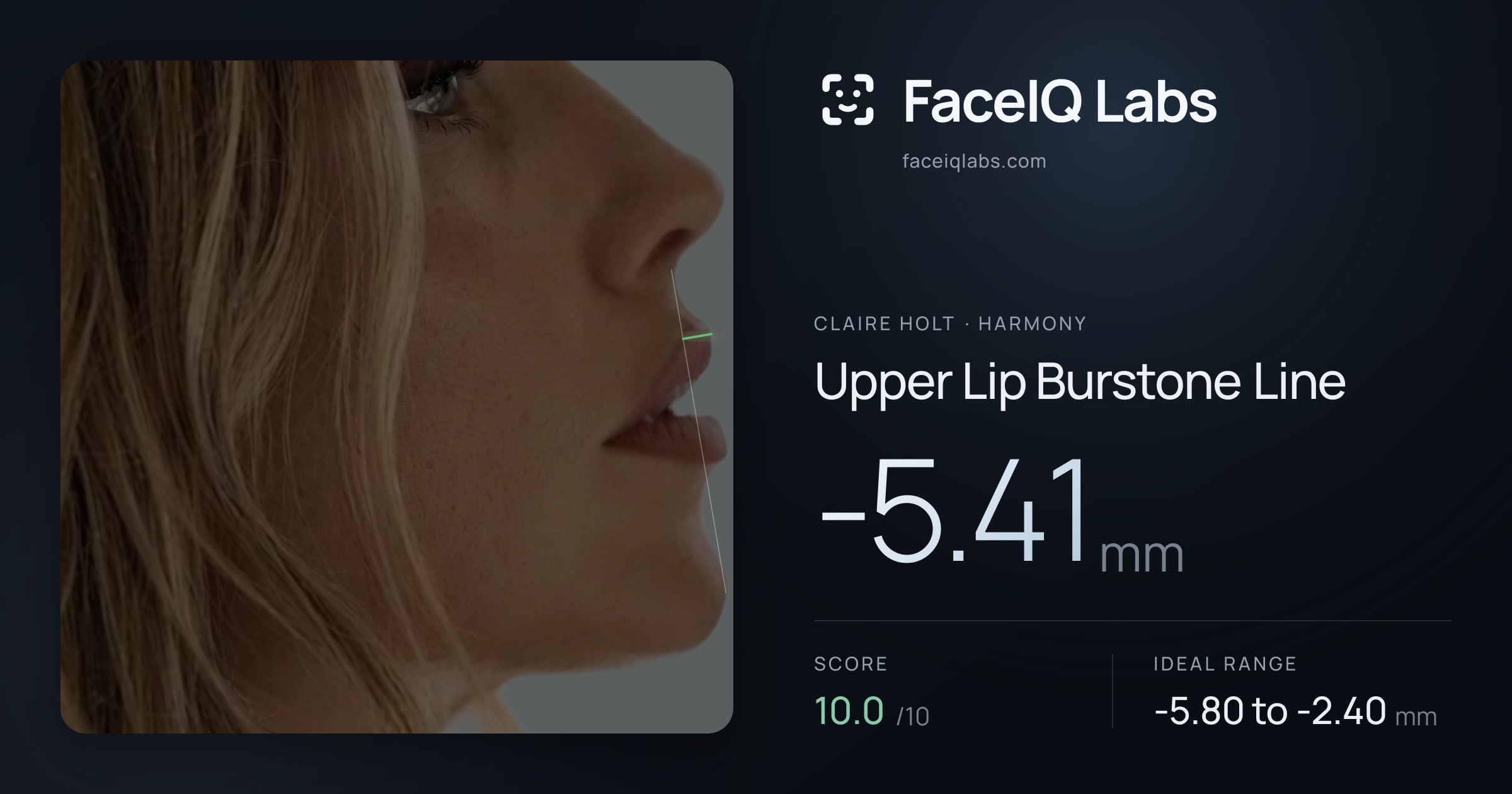 Claire Holt Upper Lip Burstone Line: -5.41mm, drawn on the photo