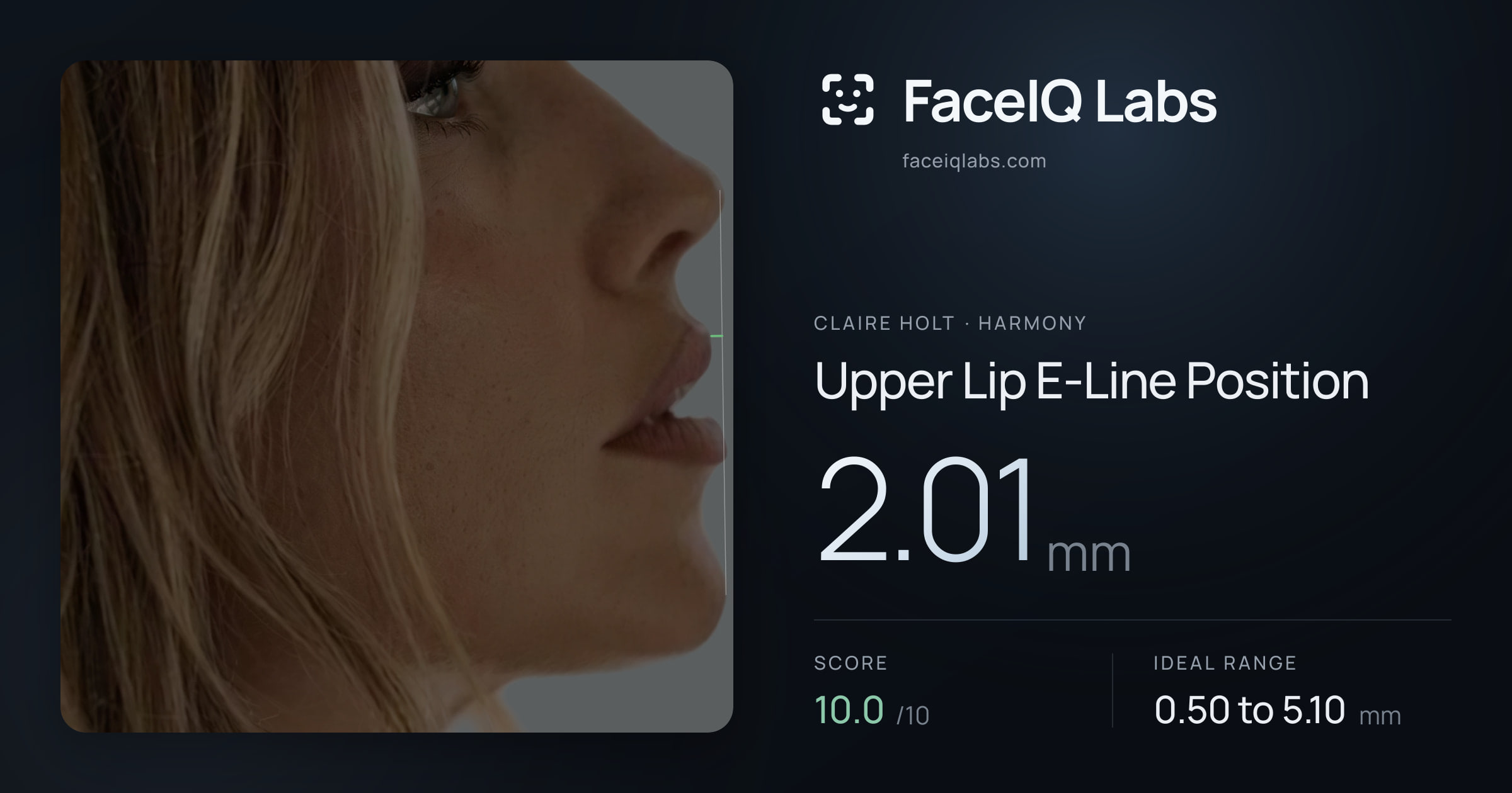 Claire Holt Upper Lip E-Line Position: 2.01mm, drawn on the photo