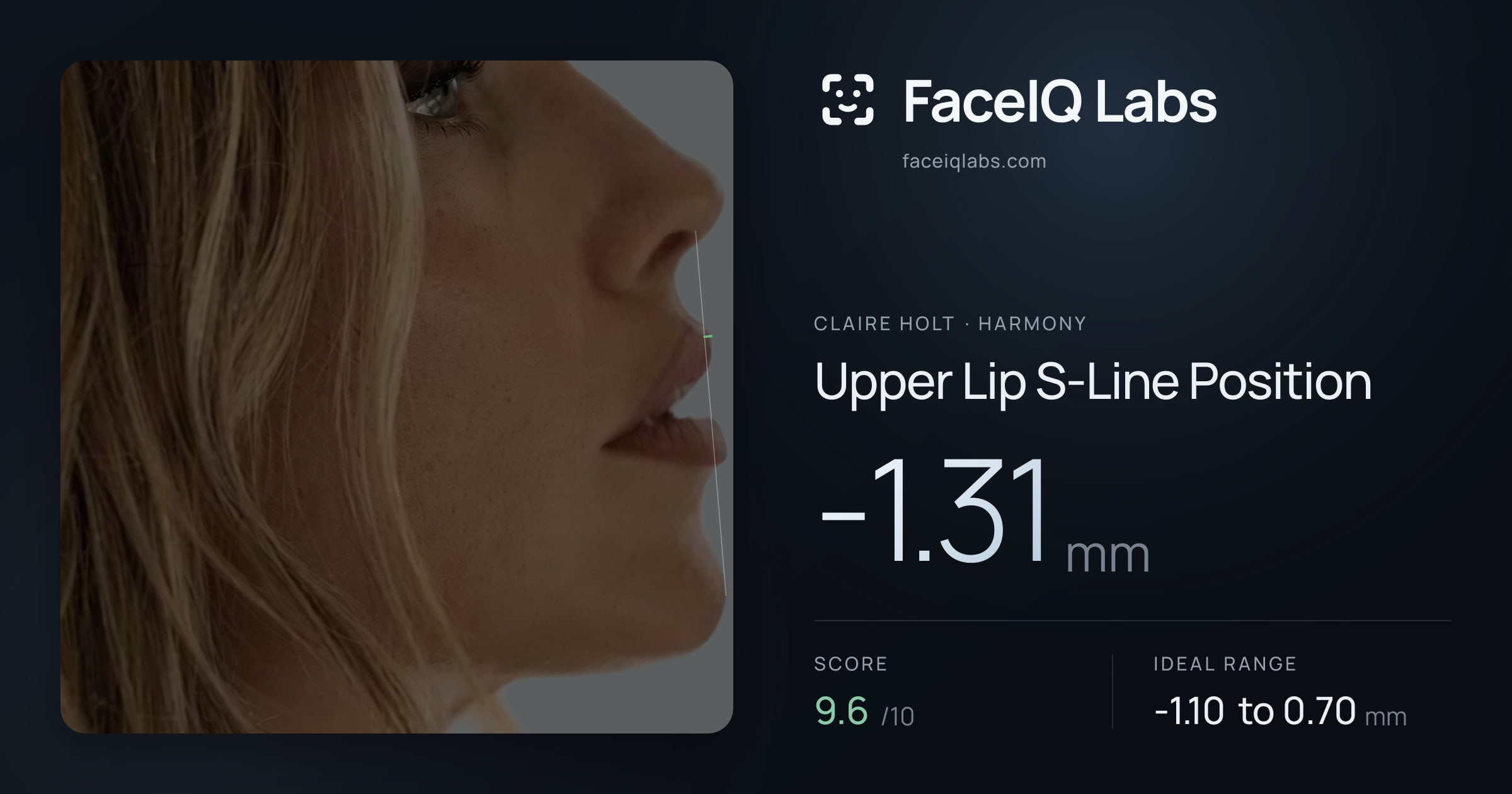 Claire Holt Upper Lip S-Line Position: -1.31mm, drawn on the photo