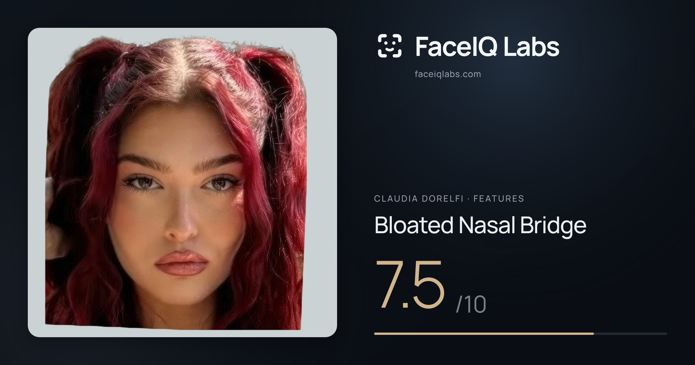 Claudia Dorelfi Bloated Nasal Bridge: 7.5/10, drawn on the photo